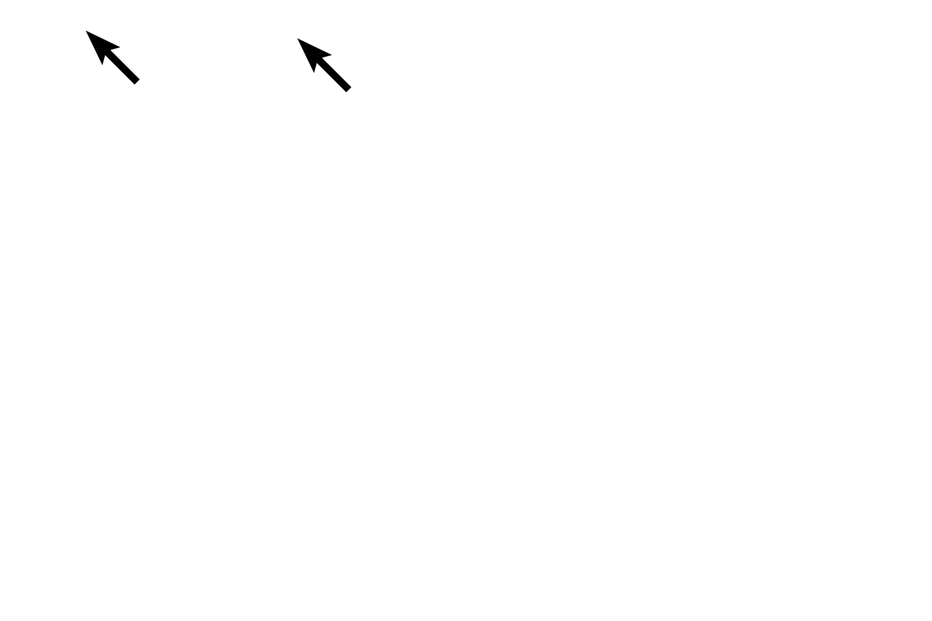  - Cilia <p>The upper panel shows an epithelium with a single layer of cells with cilia.  The epithelium in the lower panel has multiple cell layers.  All epithelia have a free surface and rest on a basement membrane.</p>
