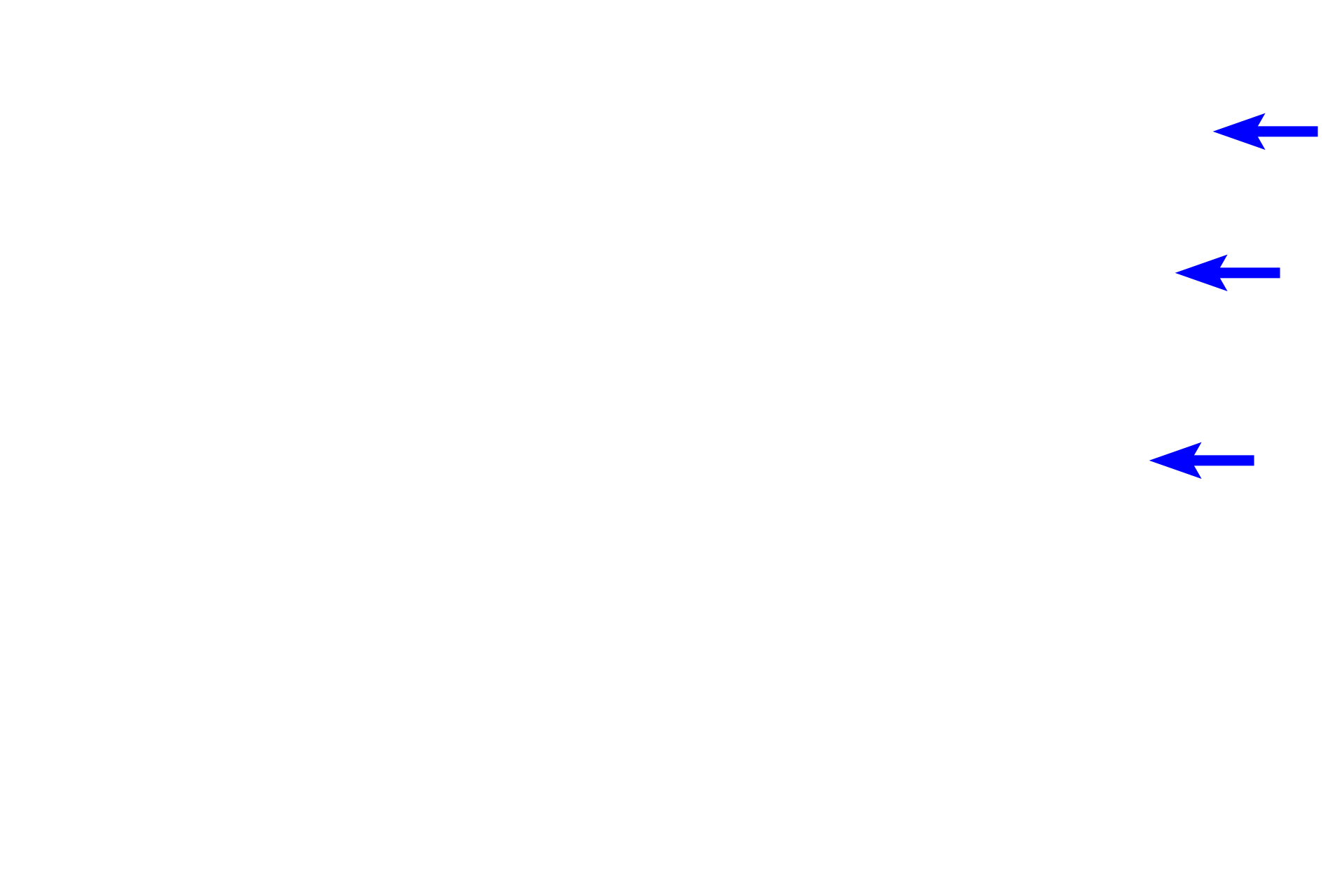  - Valve <p>Medium veins accompany muscular arteries and are often named, e.g. radial vein.  Tunica media and tunica adventitia are thicker than in small veins, with the tunica adventitia dominant.  Valves, crescent-shaped folds of the tunica intima that project into the lumen, are particularly prominent in medium veins of the lower extremities.  Medium veins transition to large veins, such as the jugular vein and vena cavae, that form the major portals for blood return to the heart.</p>
