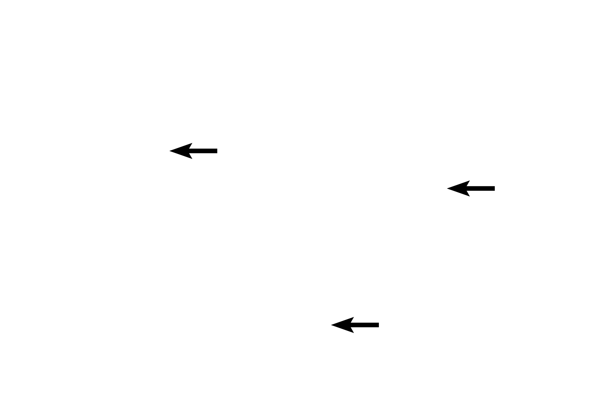  - Smooth muscle fibers <p>A feature of large veins, like the vena cava shown here, is a significant amount of longitudinally-oriented smooth muscle in the tunica adventitia.  In this H and E stained transverse section, the fibers are seen in cross section.  The tunica media consists of circularly-arranged smooth muscle and variable amounts of smooth muscle may also be present in the tunica intima.  H and E stain, 100x</p>
