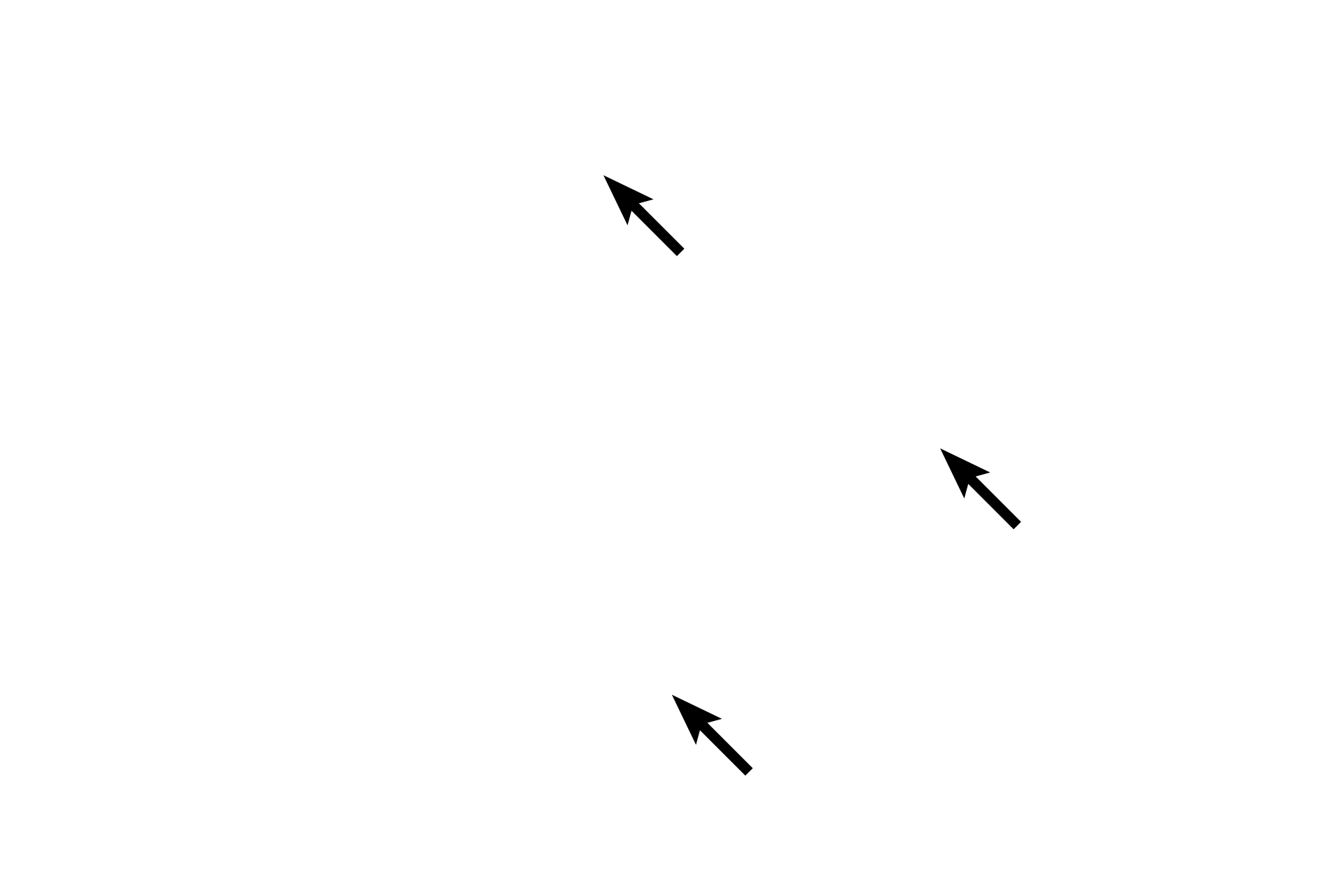  - Connective tissue <p>A feature of large veins, like the vena cava shown here, is a significant amount of longitudinally-oriented smooth muscle in the tunica adventitia.  In this H and E stained transverse section, the fibers are seen in cross section.  The tunica media consists of circularly-arranged smooth muscle and variable amounts of smooth muscle may also be present in the tunica intima.  H and E stain, 100x</p>

