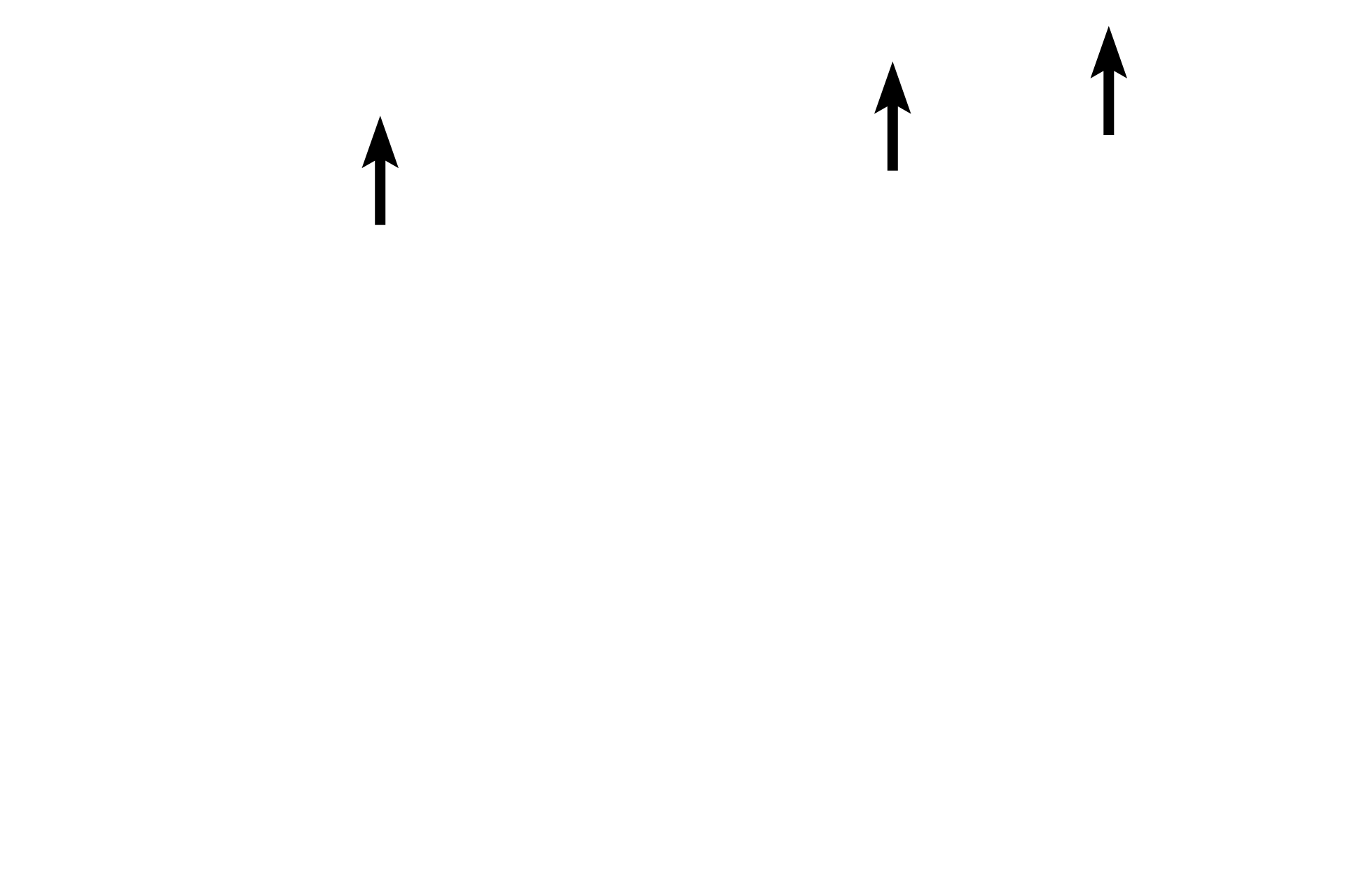  - Smooth muscle fibers <p>At higher magnification, the components of the three tunics are evident in this H & E stained cross section.  The tunica intima contains smooth muscle in the subendothelial connective tissue.  The tunica media consists of circularly-arranged muscle.  The tunica adventitia contains large amounts of longitudinally-oriented smooth muscle fibers interspersed with connective tissue.  400x</p>
