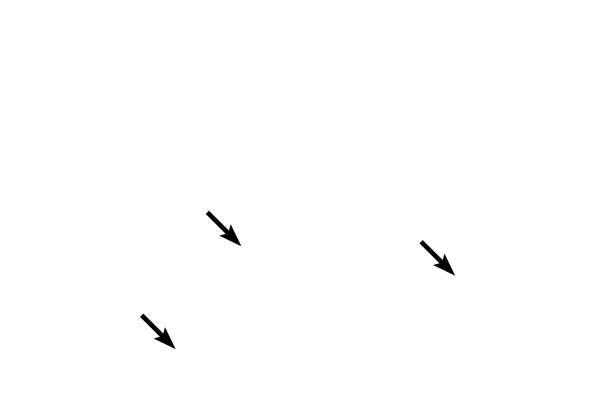  - Connective tissue <p>At higher magnification, the components of the three tunics are evident in this H & E stained cross section.  The tunica intima contains smooth muscle in the subendothelial connective tissue.  The tunica media consists of circularly-arranged muscle.  The tunica adventitia contains large amounts of longitudinally-oriented smooth muscle fibers interspersed with connective tissue.  400x</p>

