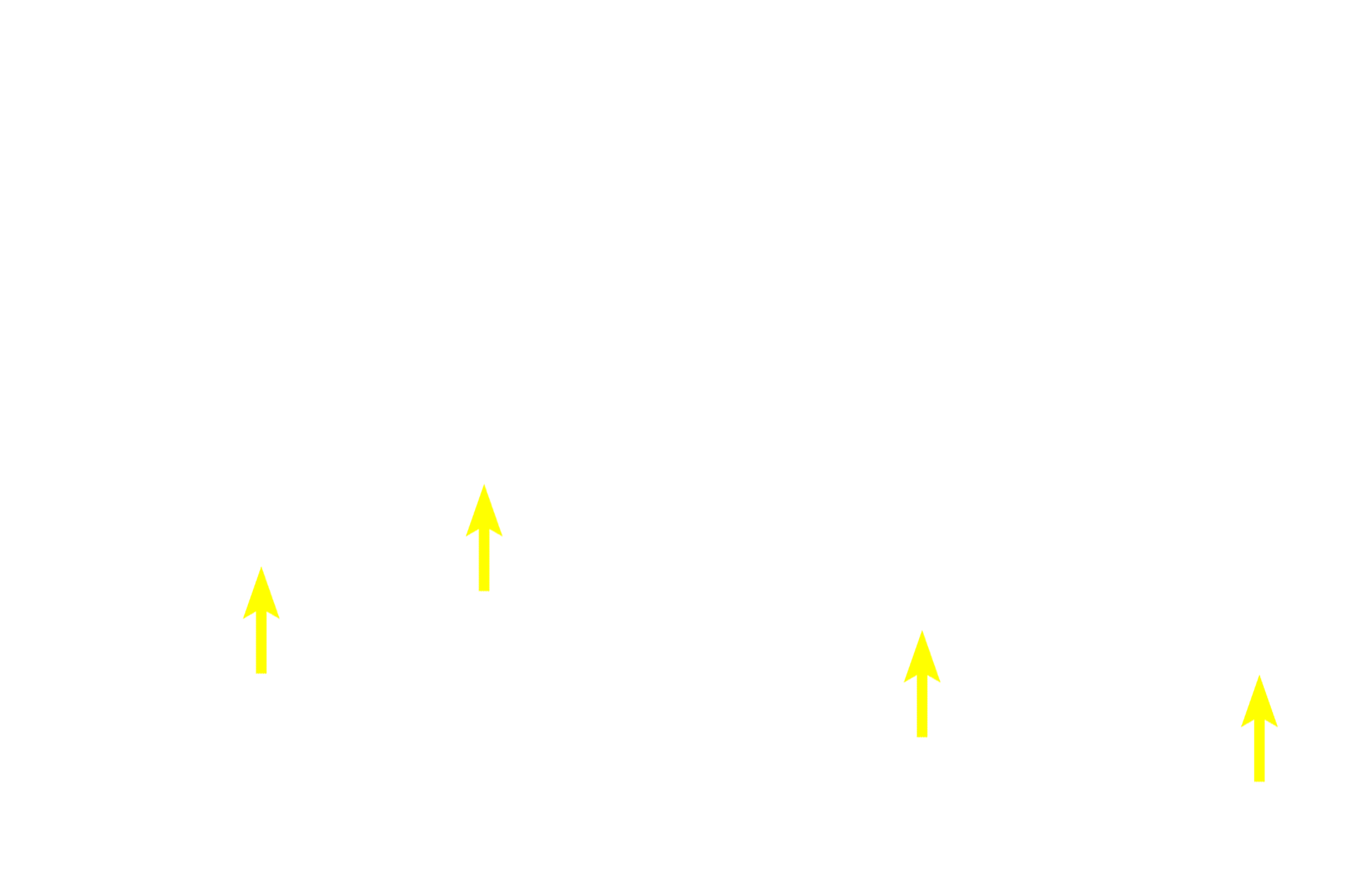  - Elastic fibers <p>Because this large vein is sectioned longitudinally, the orientation of the smooth muscle fibers is reversed from that shown in the previous cross sections.  In this orientation, longitudinally-oriented smooth muscle fibers in tunicae intima and adventitia are seen in longitudinal section, and the circularly arranged smooth muscle in the tunica media is seen in cross section. This section was stained for elastic fibers, thus an internal elastic lamina, which is present in larger veins, is prominent.  100x, 250x</p>
