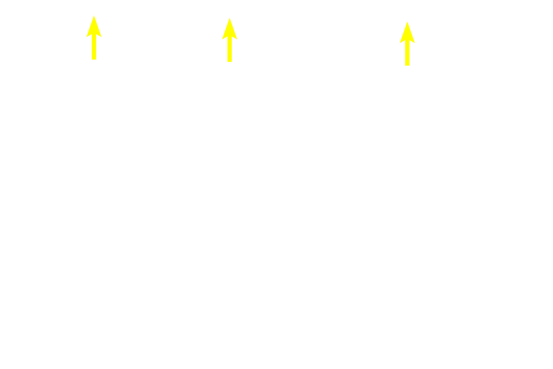  - Endothelium <p>Because this large vein is sectioned longitudinally, the orientation of the smooth muscle fibers is reversed from that shown in the previous cross sections.  In this orientation, longitudinally-oriented smooth muscle fibers in tunicae intima and adventitia are seen in longitudinal section, and the circularly arranged smooth muscle in the tunica media is seen in cross section. This section was stained for elastic fibers, thus an internal elastic lamina, which is present in larger veins, is prominent.  100x, 250x</p>
