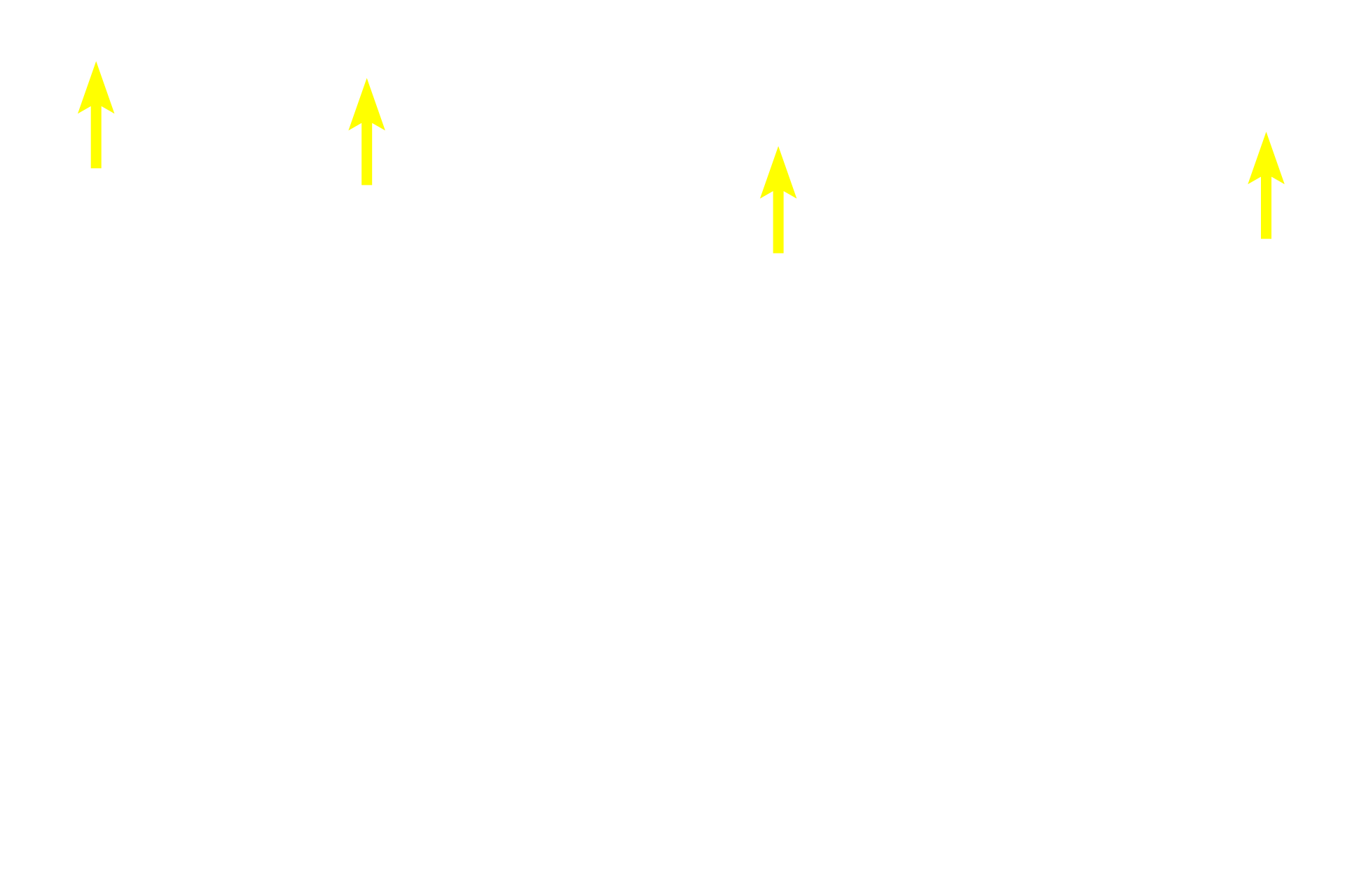  - Internal elastic lamina <p>Because this large vein is sectioned longitudinally, the orientation of the smooth muscle fibers is reversed from that shown in the previous cross sections.  In this orientation, longitudinally-oriented smooth muscle fibers in tunicae intima and adventitia are seen in longitudinal section, and the circularly arranged smooth muscle in the tunica media is seen in cross section. This section was stained for elastic fibers, thus an internal elastic lamina, which is present in larger veins, is prominent.  100x, 250x</p>
