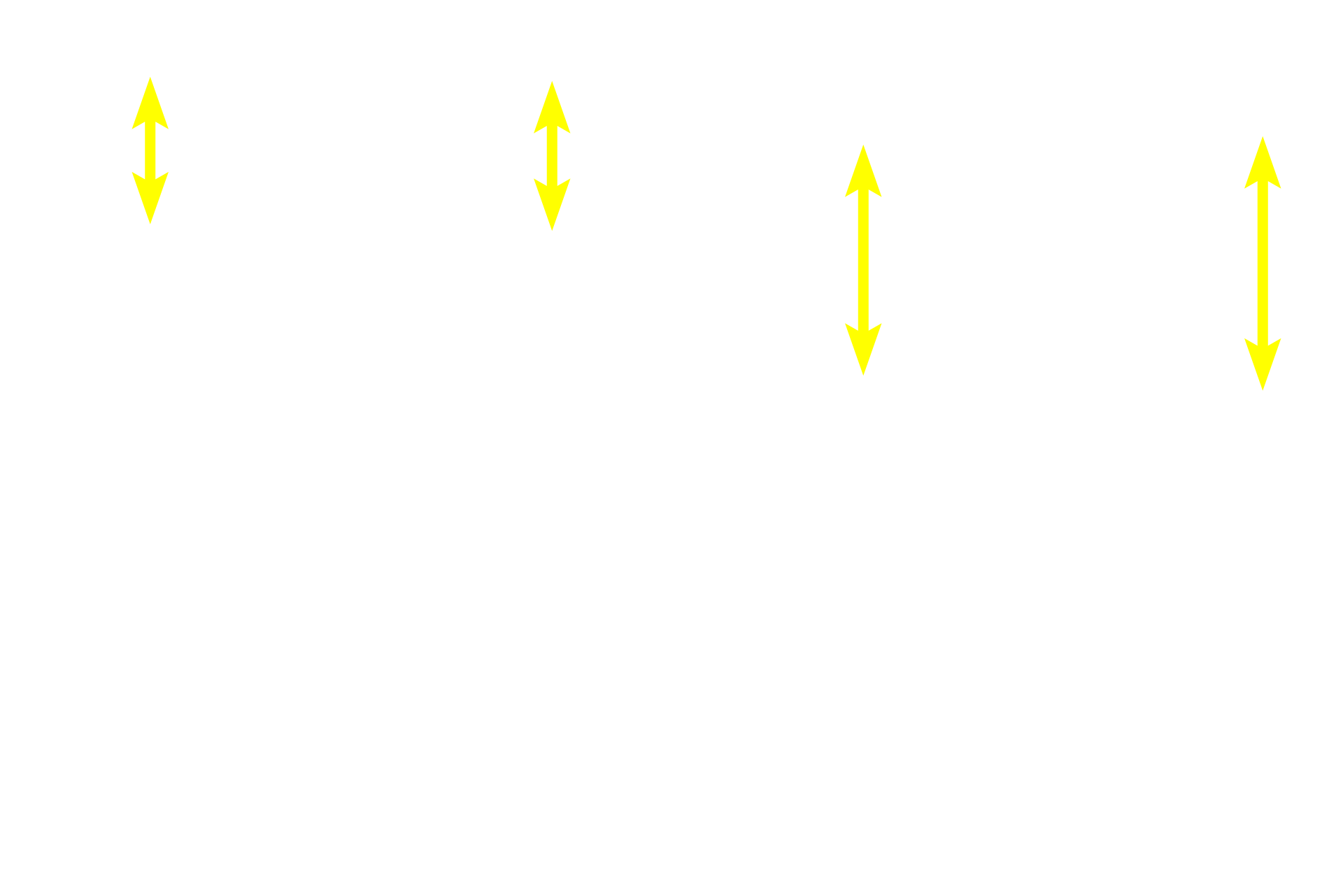 Tunica media <p>Because this large vein is sectioned longitudinally, the orientation of the smooth muscle fibers is reversed from that shown in the previous cross sections.  In this orientation, longitudinally-oriented smooth muscle fibers in tunicae intima and adventitia are seen in longitudinal section, and the circularly arranged smooth muscle in the tunica media is seen in cross section. This section was stained for elastic fibers, thus an internal elastic lamina, which is present in larger veins, is prominent.  100x, 250x</p>

