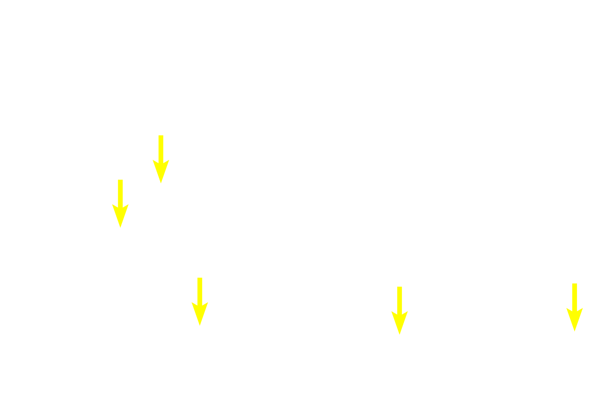  - Smooth muscle fibers <p>Because this large vein is sectioned longitudinally, the orientation of the smooth muscle fibers is reversed from that shown in the previous cross sections.  In this orientation, longitudinally-oriented smooth muscle fibers in tunicae intima and adventitia are seen in longitudinal section, and the circularly arranged smooth muscle in the tunica media is seen in cross section. This section was stained for elastic fibers, thus an internal elastic lamina, which is present in larger veins, is prominent.  100x, 250x</p>
