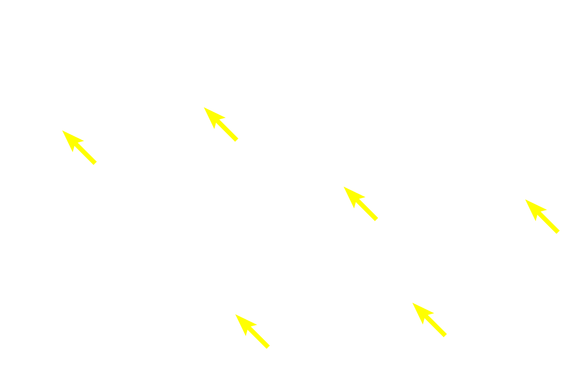  - Connective tissue <p>Because this large vein is sectioned longitudinally, the orientation of the smooth muscle fibers is reversed from that shown in the previous cross sections.  In this orientation, longitudinally-oriented smooth muscle fibers in tunicae intima and adventitia are seen in longitudinal section, and the circularly arranged smooth muscle in the tunica media is seen in cross section. This section was stained for elastic fibers, thus an internal elastic lamina, which is present in larger veins, is prominent.  100x, 250x</p>
