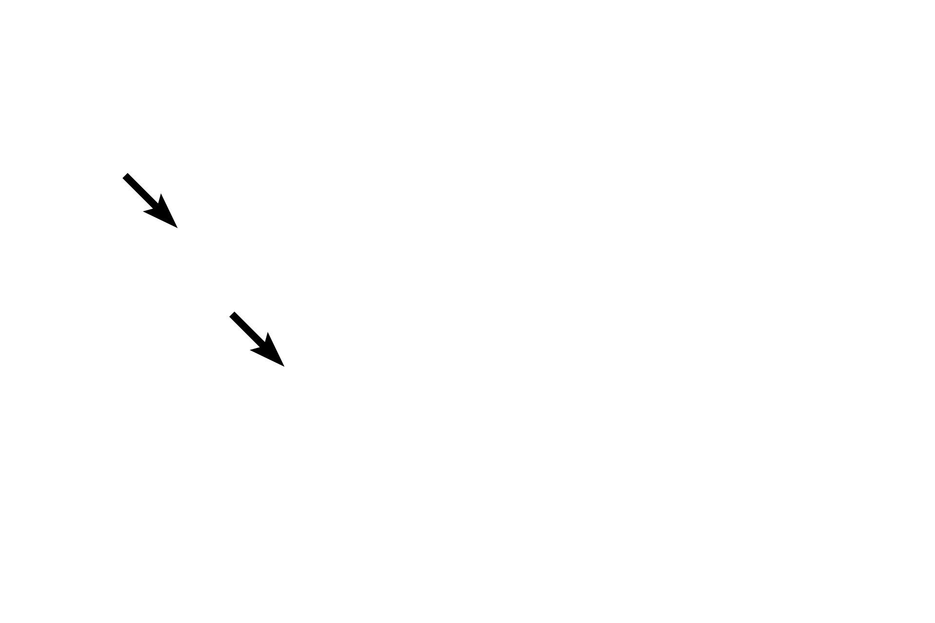 Internal elastic lamina <p>A larger venule is compared with its accompanying arteriole. The venule displays an irregular outline and its wall consists of an endothelium and clearly visible subendothelial connective tissue.  The wall of the venule is much thinner than that of the arteriole it accompanies. The arteriole has a circular outline, a visible internal elastic lamina, and a prominent tunica media consisting of 2-3 layers of smooth muscle.  400x</p>
