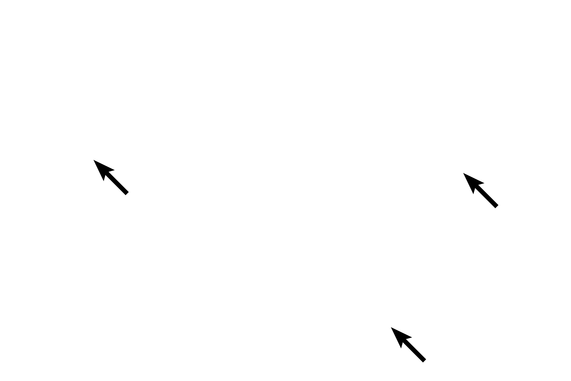 Tunica media <p>Larger venules transition into small veins where all three tunics are well represented.  Also appearing in small veins are valves which are formed by paired, crescent-shaped folds (leaflets) of the tunica intima that project into the lumen. These valves help prevent the back flow of blood. Small veins have a tunica media composed of circularly-arranged smooth muscle cells.  200x</p>
