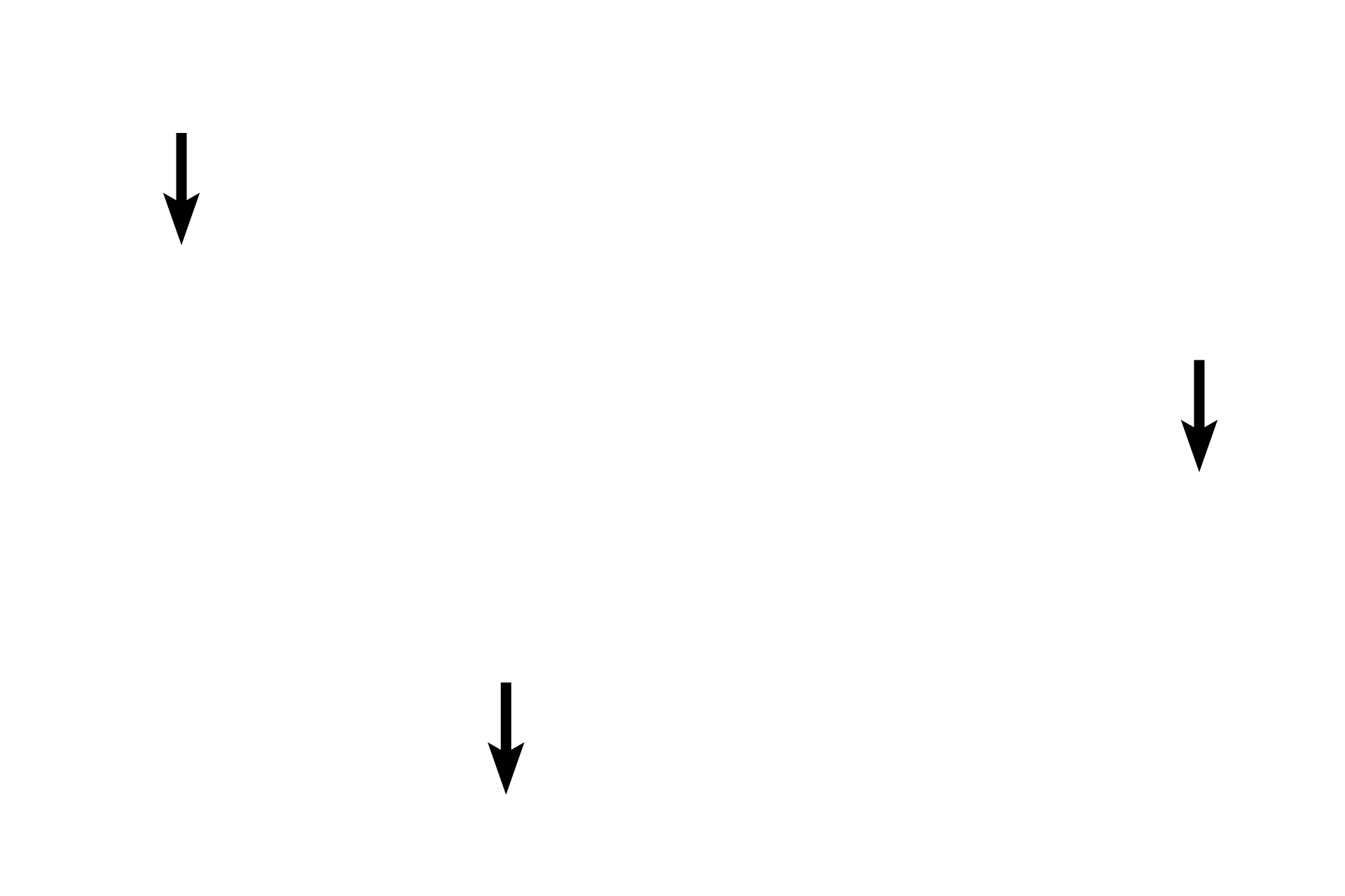 Tunica adventitia <p>Larger venules transition into small veins where all three tunics are well represented.  Also appearing in small veins are valves which are formed by paired, crescent-shaped folds (leaflets) of the tunica intima that project into the lumen. These valves help prevent the back flow of blood. Small veins have a tunica media composed of circularly-arranged smooth muscle cells.  200x</p>
