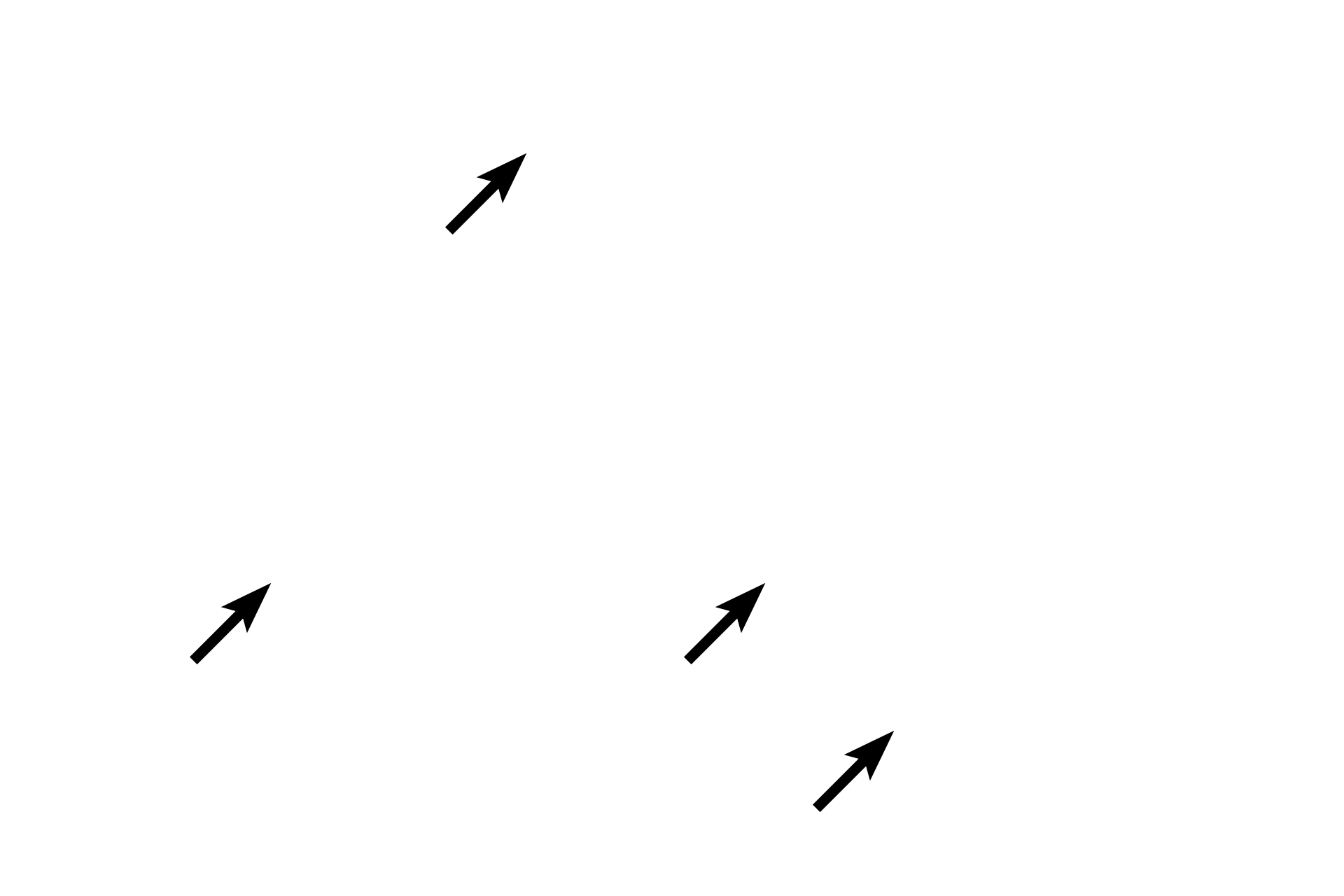 Tunica intima <p>In medium veins, each of the tunics increases in width, with a well-defined tunica adventitia predominating.  Medium veins are often named, e.g., radial, tibial and popliteal.  Accompanying this vein is a muscular artery.  40x, 200x</p>
