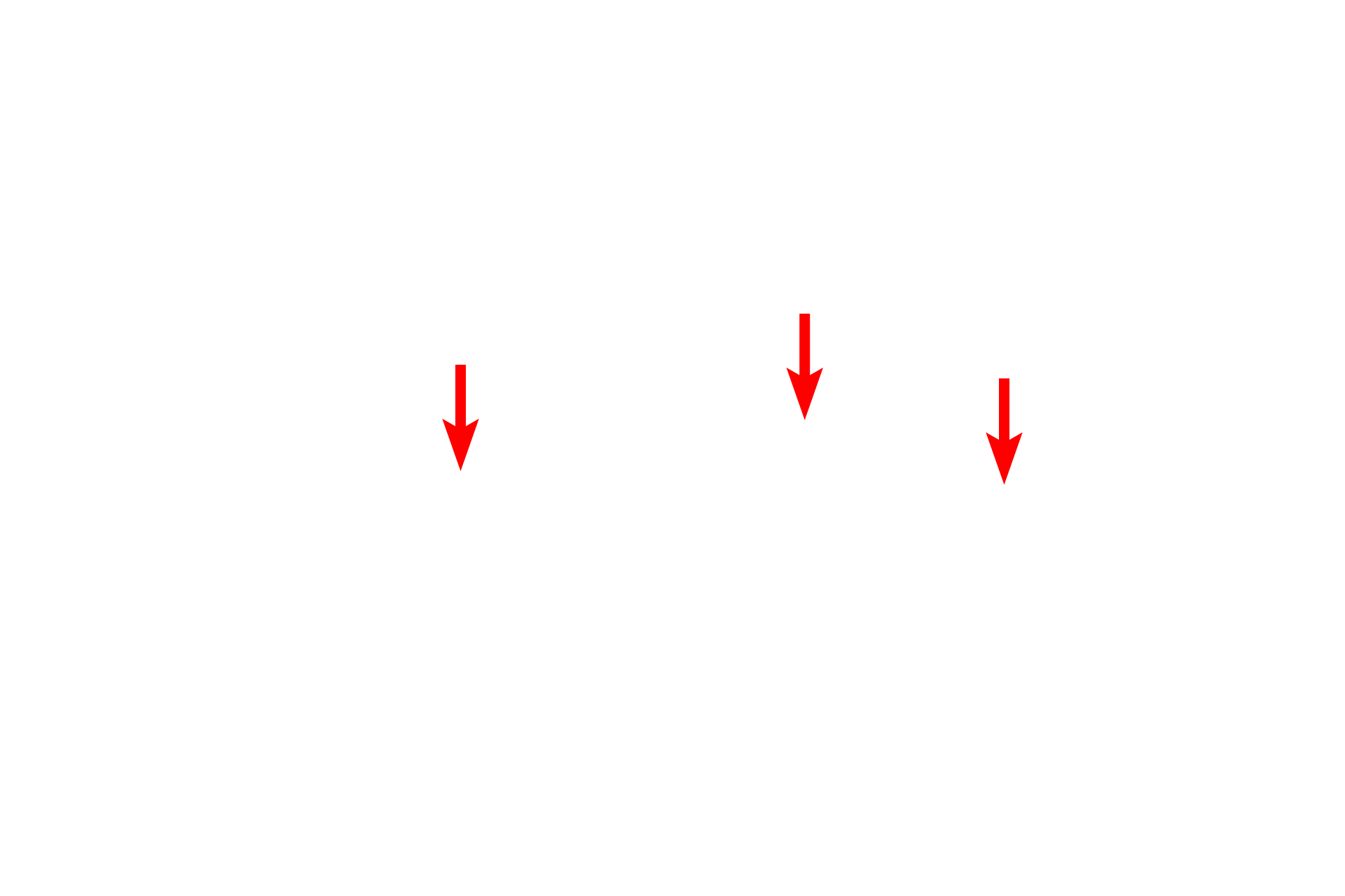  - Neurofilaments <p>Axons contain an abundant cytoskeleton, notably, large numbers of microtubules for transport and neurofilaments for support and stability.</p>
