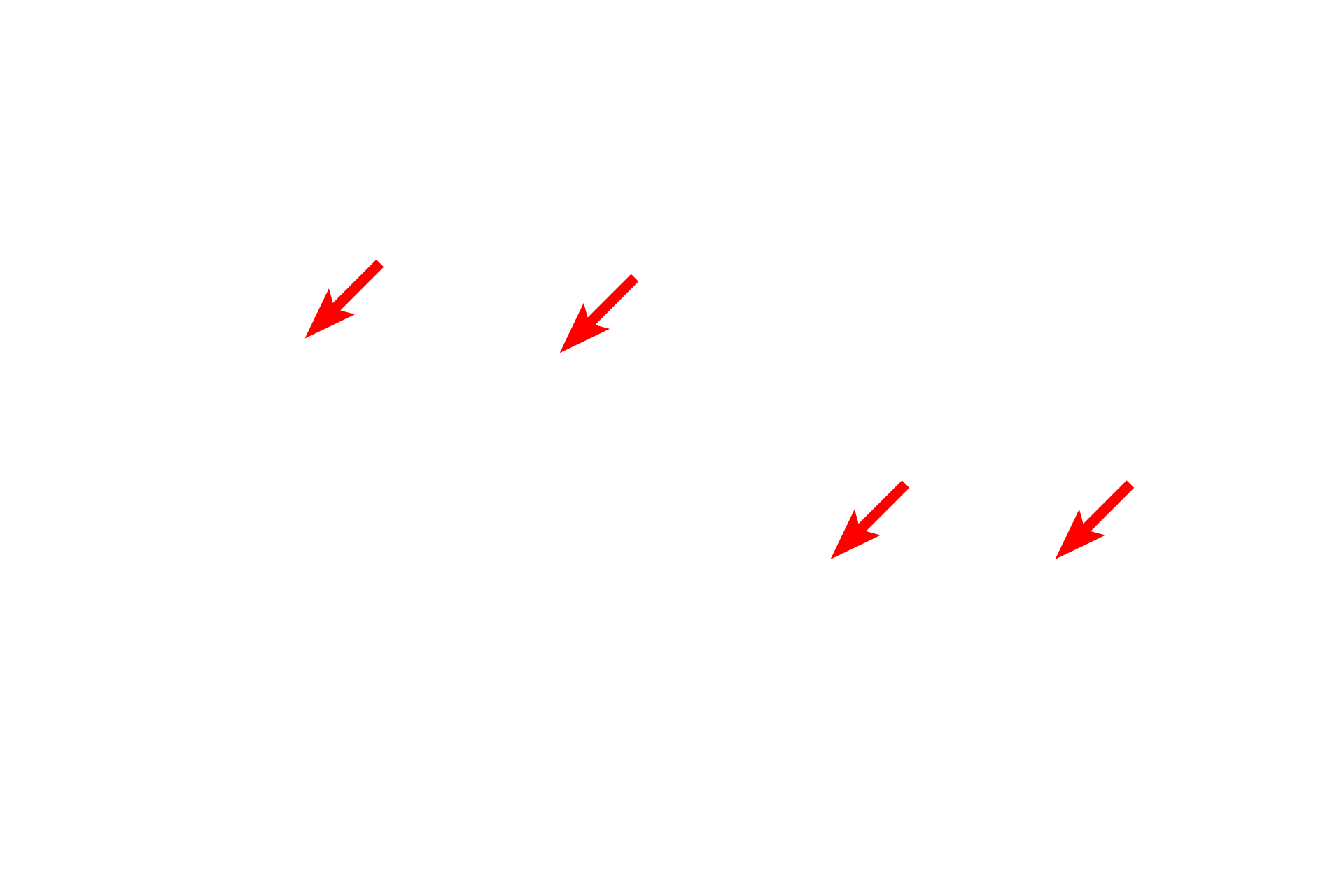   -- Paranodal loops <p>Paranodes, located at the ends of an internode adjacent to the node of Ranvier, consist of uncompacted myelin membranes.  The paranode consists of cytoplasm-filled, plasma membrane loops (paranodal loops) of the myelinating cells.  Each loop contacts the axon membrane forming tight junctions that anchor the internode to the axon and restrict the lateral movement of the sodium channels.</p>
