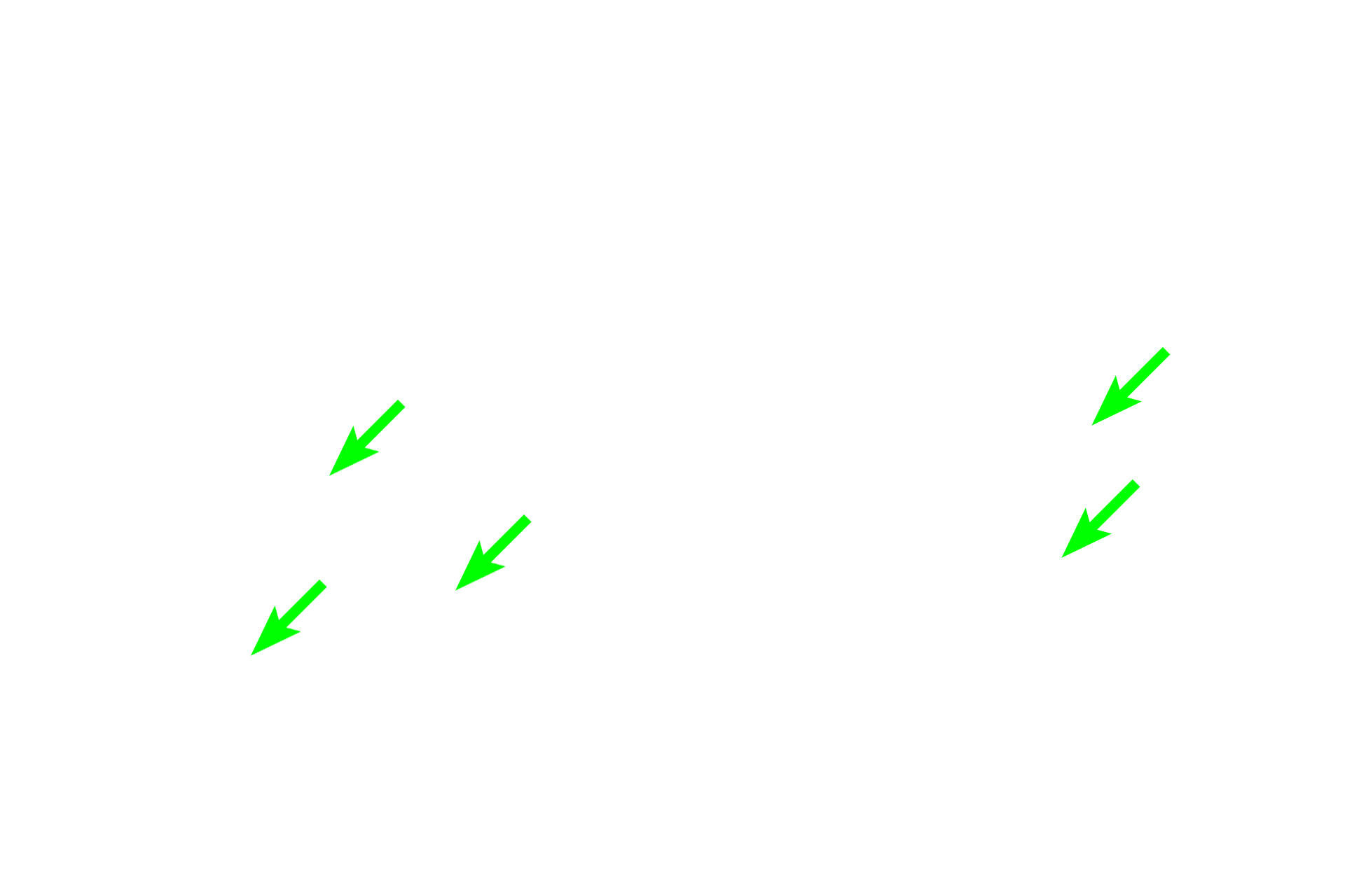 Lipid vacuoles <p>Leydig (interstitial) cells constitute the endocrine portion of the testis.  They produce the steroid hormone, testosterone.  Steroid-secreting cells commonly have vacuoles in their cytoplasm, resulting from extraction of the lipid precursor molecules used in steroid synthesis. Blood vessels and lymphatics are abundant in the interstitium surrounding these cells. 1000x</p>
