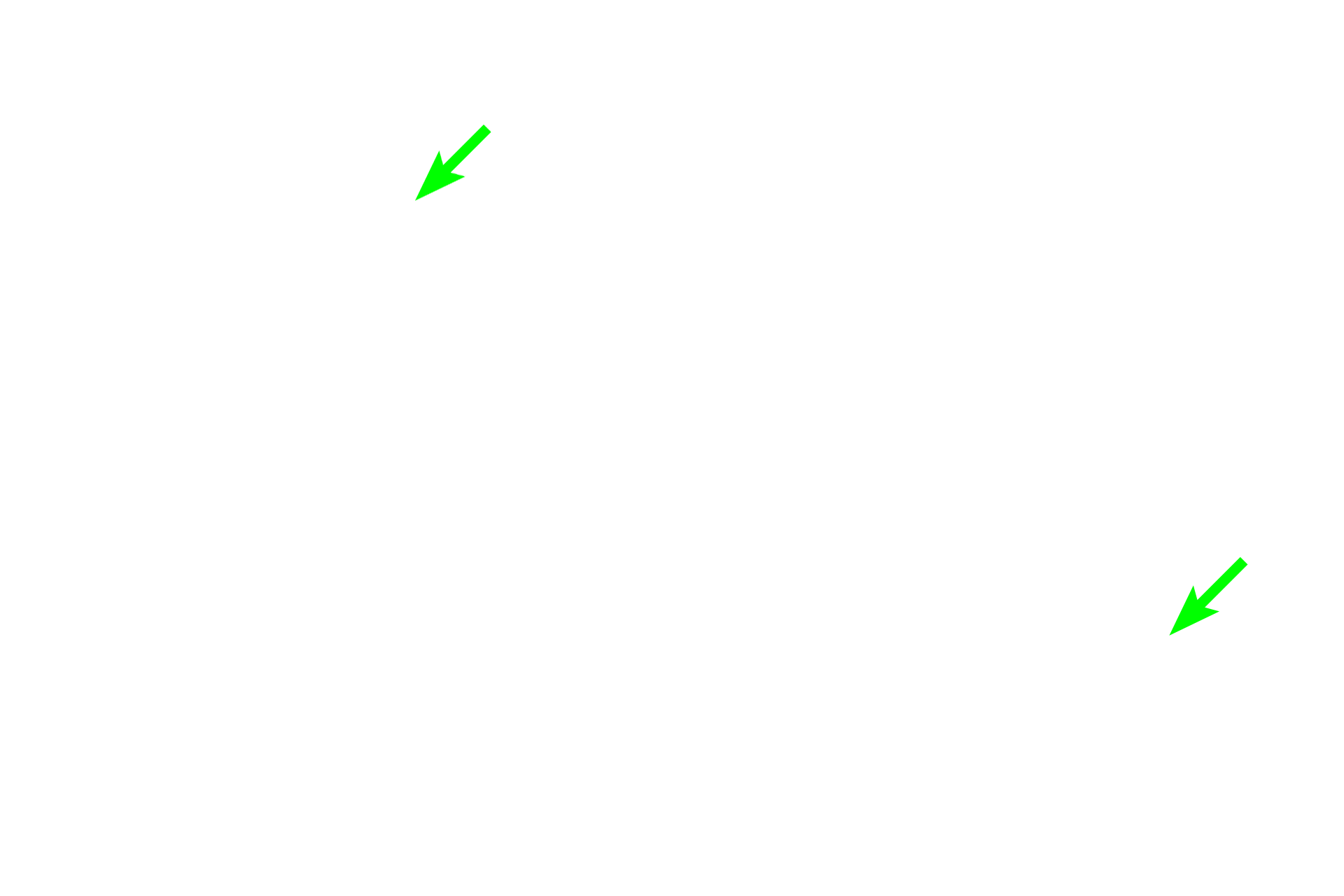 Blood vessels <p>Leydig (interstitial) cells constitute the endocrine portion of the testis.  They produce the steroid hormone, testosterone.  Steroid-secreting cells commonly have vacuoles in their cytoplasm, resulting from extraction of the lipid precursor molecules used in steroid synthesis. Blood vessels and lymphatics are abundant in the interstitium surrounding these cells. 1000x</p>
