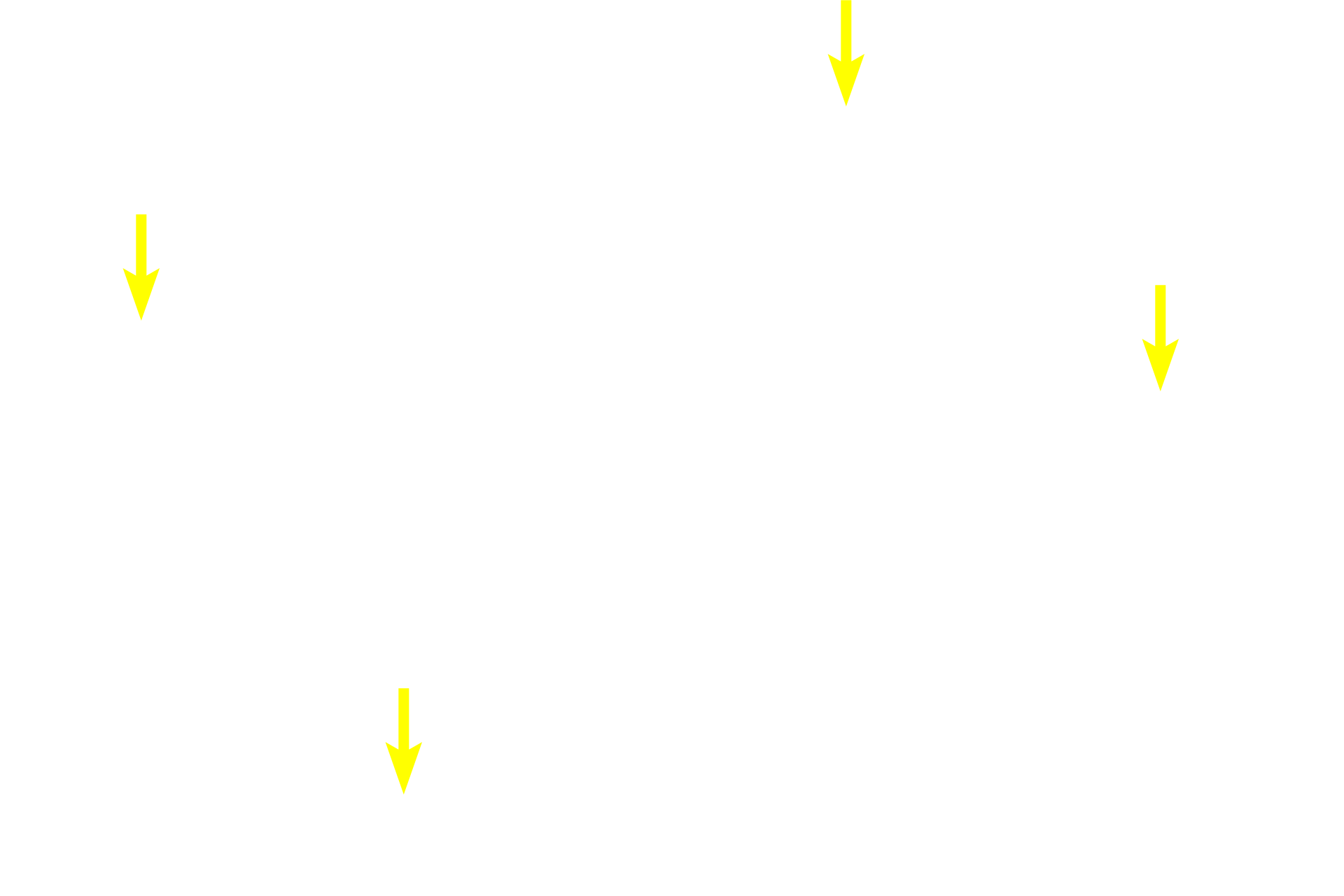 Spermatogonia <p>The germinal epithelium of the convoluted portions of the seminiferous tubules is composed of Sertoli cells, diploid spermatogonia, primary spermatocytes, haploid secondary spermatocytes and spermatids. 600x</p>
