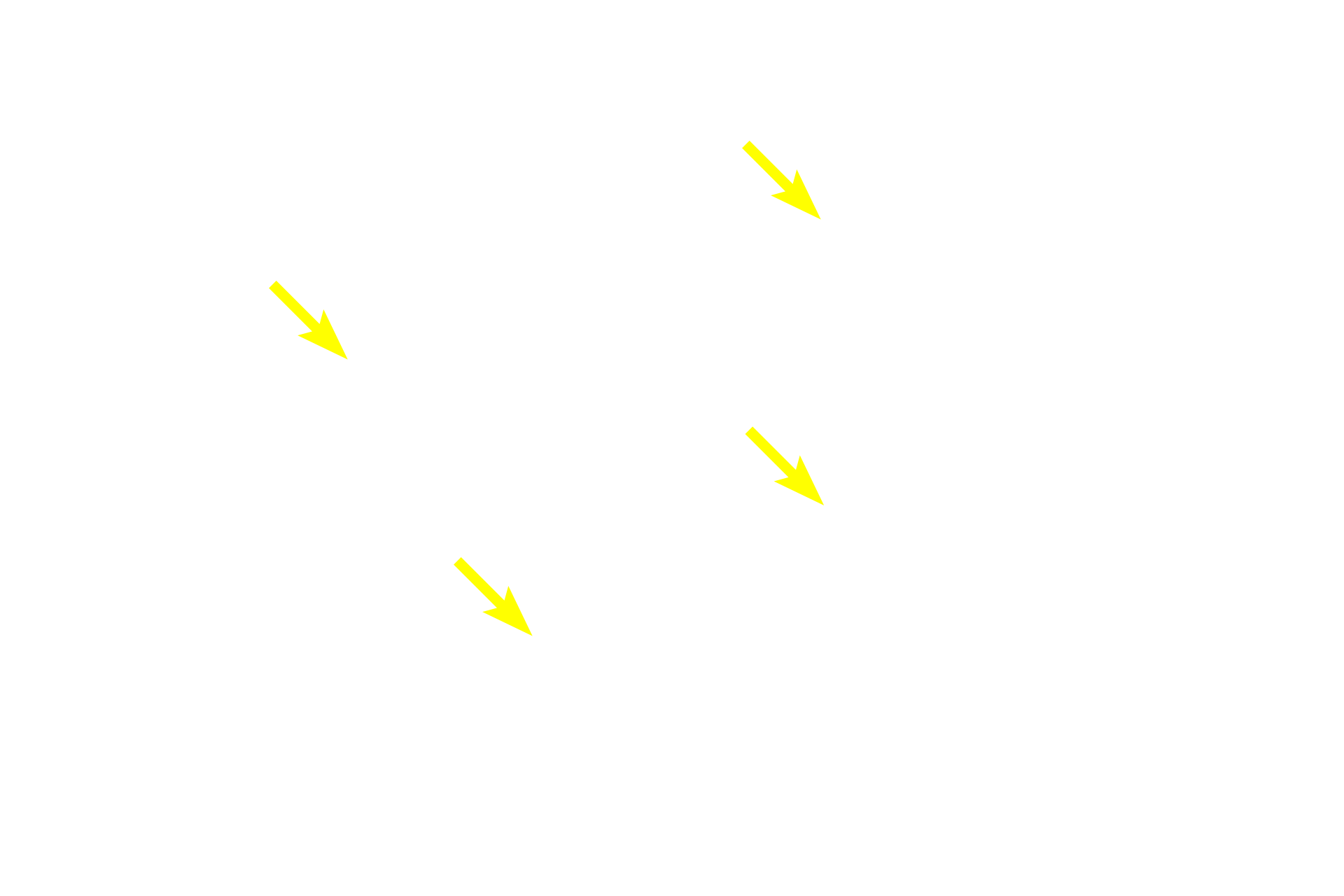 Spermatids (early) <p>The germinal epithelium of the convoluted portions of the seminiferous tubules is composed of Sertoli cells, diploid spermatogonia, primary spermatocytes, haploid secondary spermatocytes and spermatids. 600x</p>
