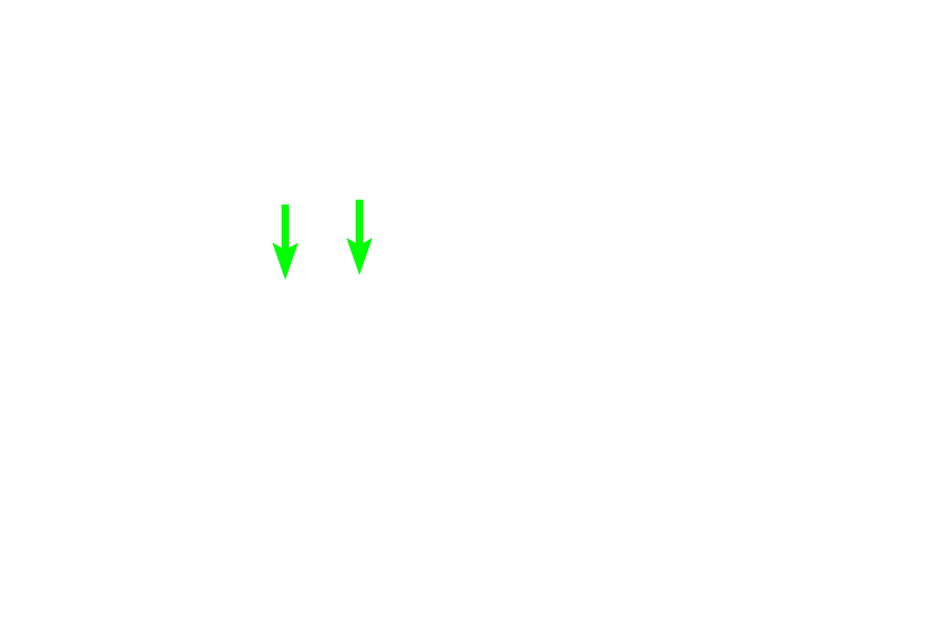 Residual bodies <p>The germinal epithelium of the convoluted portions of the seminiferous tubules is composed of Sertoli cells, diploid spermatogonia, primary spermatocytes, haploid secondary spermatocytes and spermatids. 600x</p>
