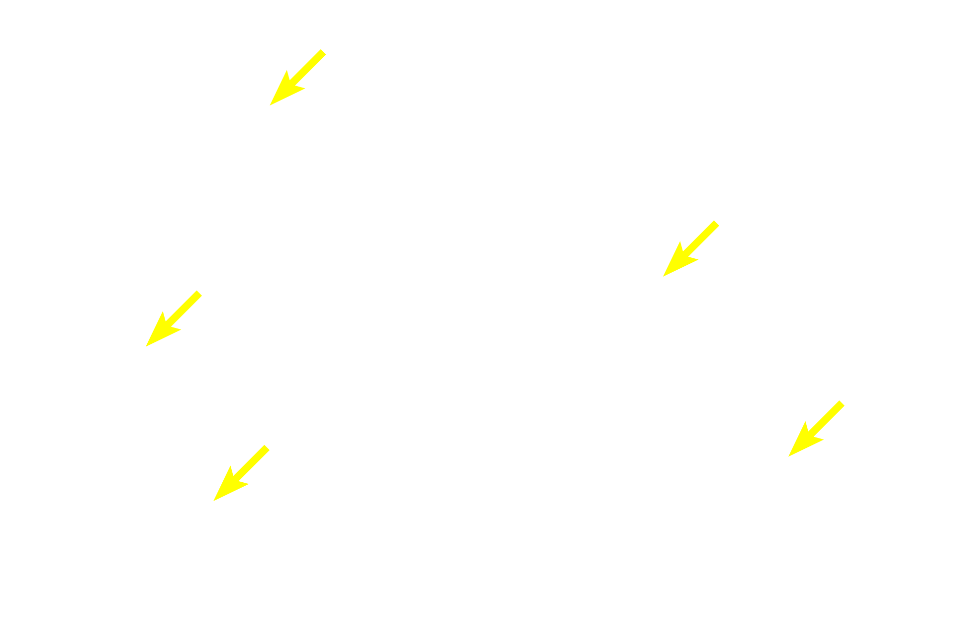 Spermatids (early) <p>Spermatogenesis has four phases: spermatocytogenesis (mitotic division of spermatogonia to primary spermatocytes); meiosis (a two-step division of primary spermatocytes to secondary spermatocytes to spermatids); spermiogenesis (cytodifferentiation of spermatids into mature spermatozoa); and spermiation (the release of sperm from Sertoli cells). 600X</p>
