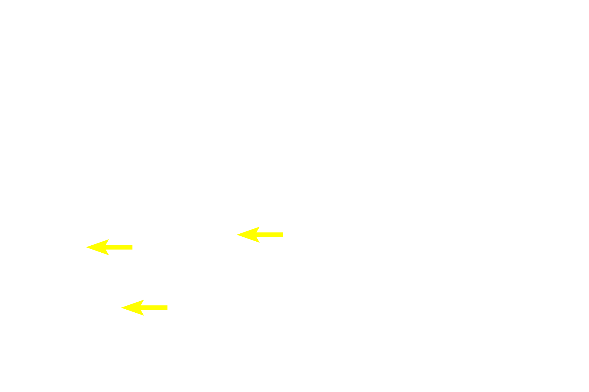 Early spermatids <p>Primary spermatocytes, the largest cells in the spermatogenic lineage, form from mitotic division of spermatogonia in the basal compartment. Primaries migrate through the blood-testis barrier and enter a prolonged period of prophase of meiosis I. Primary spermatocytes complete meiosis I, the reductional phase, to produce haploid secondary spermatocytes. 1000x</p>
