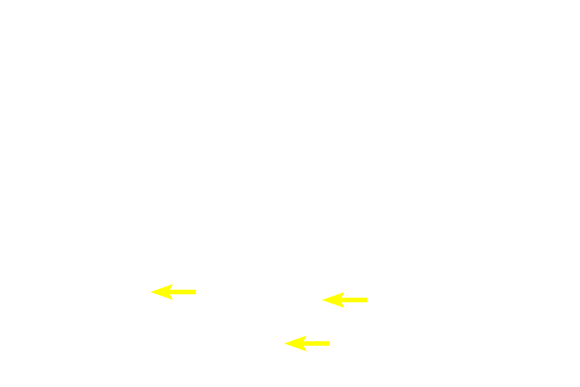 Sertoli cells <p>Primary spermatocytes, the largest cells in the spermatogenic lineage, form from mitotic division of spermatogonia in the basal compartment. Primaries migrate through the blood-testis barrier and enter a prolonged period of prophase of meiosis I. Primary spermatocytes complete meiosis I, the reductional phase, to produce haploid secondary spermatocytes. 1000x</p>

