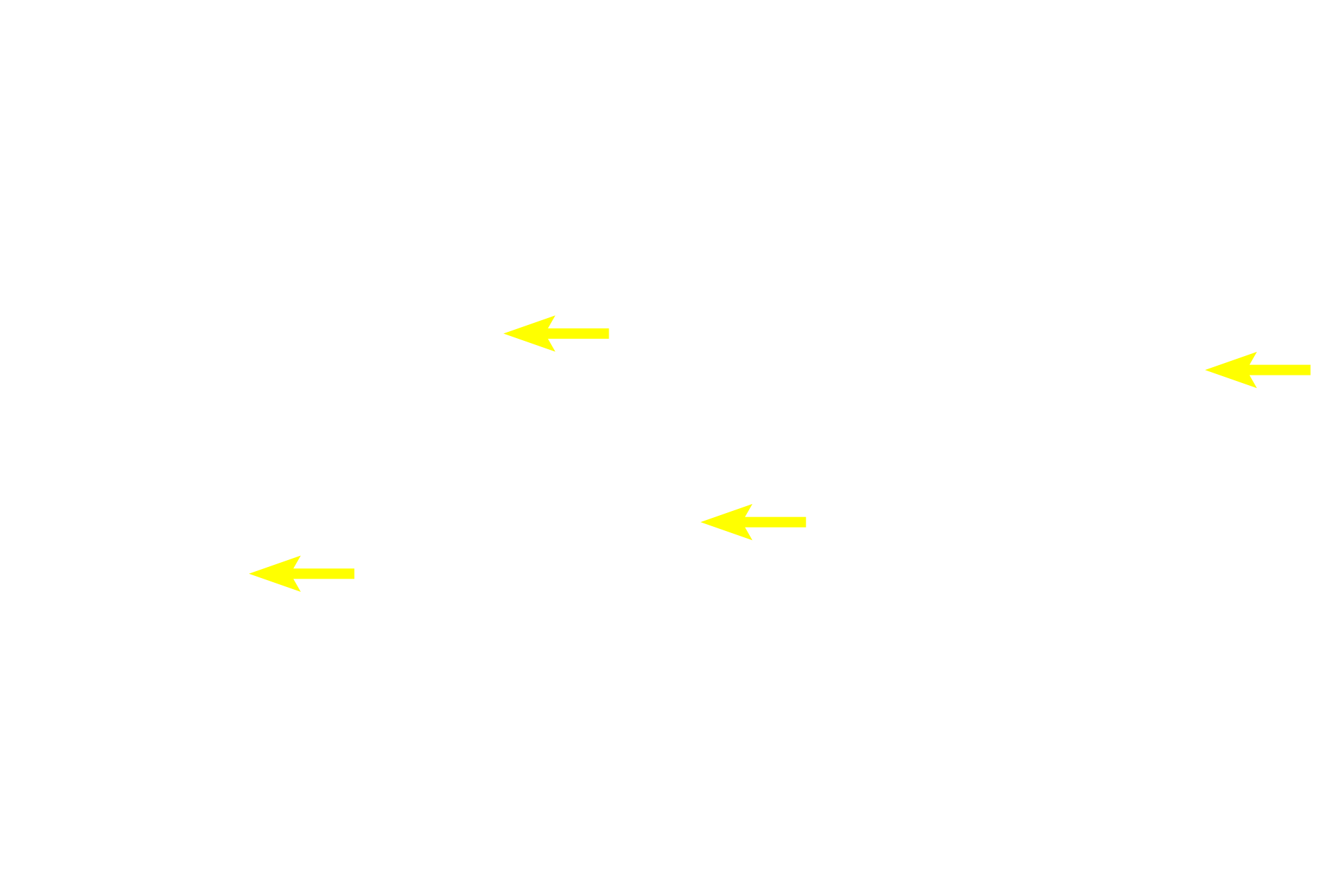 Early spermatids <p>This region of the seminiferous epithelium contains numerous spermatogonia. These cells are identified as spermatogonia based on their location next to the basement membrane. The primary spermatocytes resulting from the mitotic divisions of spermatogonia migrate into the adluminal compartment where they rapidly enter prophase of meiosis I. 1000x</p>
