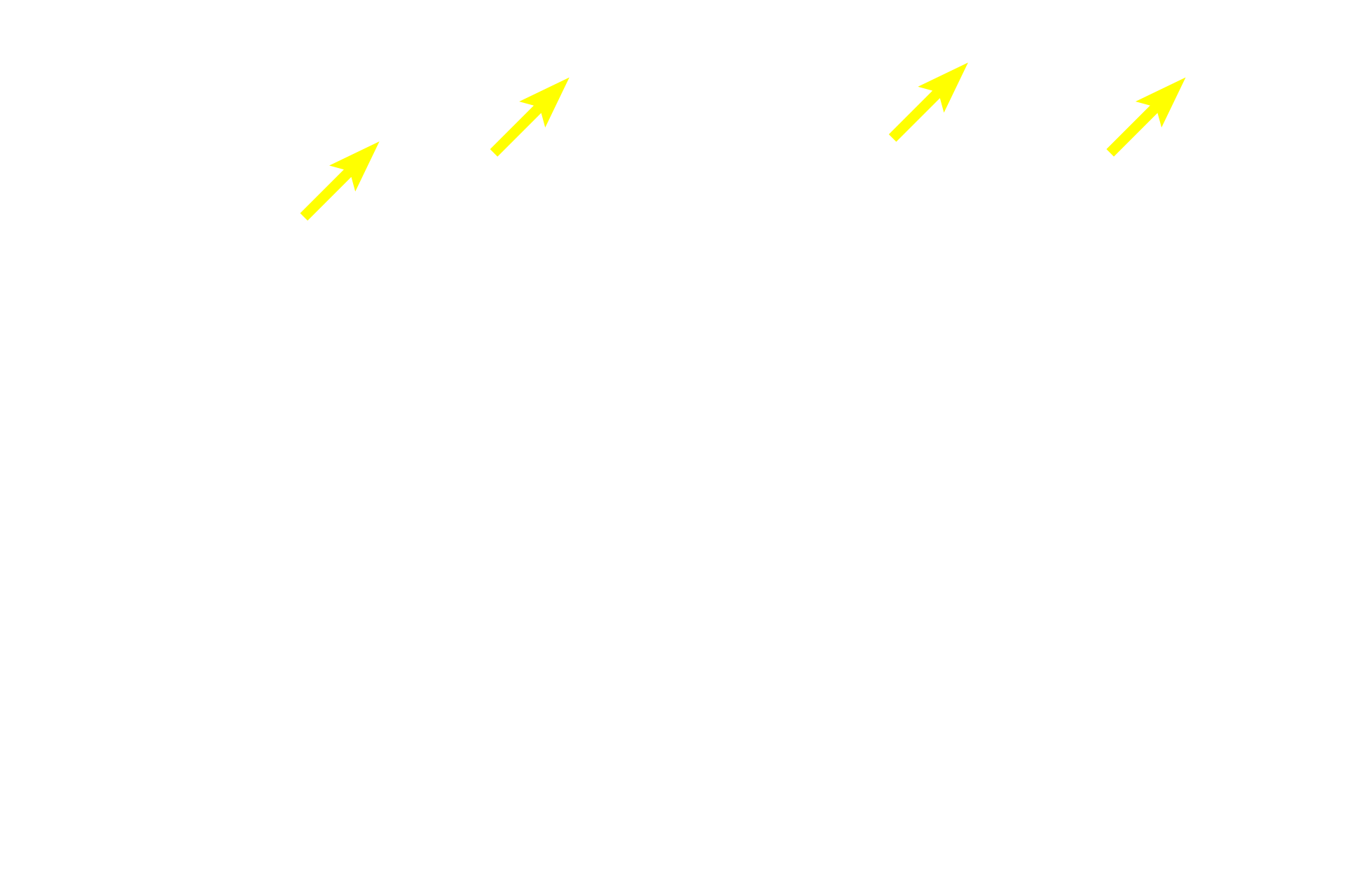 Late spermatids <p>This region of the seminiferous epithelium contains numerous spermatogonia. These cells are identified as spermatogonia based on their location next to the basement membrane. The primary spermatocytes resulting from the mitotic divisions of spermatogonia migrate into the adluminal compartment where they rapidly enter prophase of meiosis I. 1000x</p>
