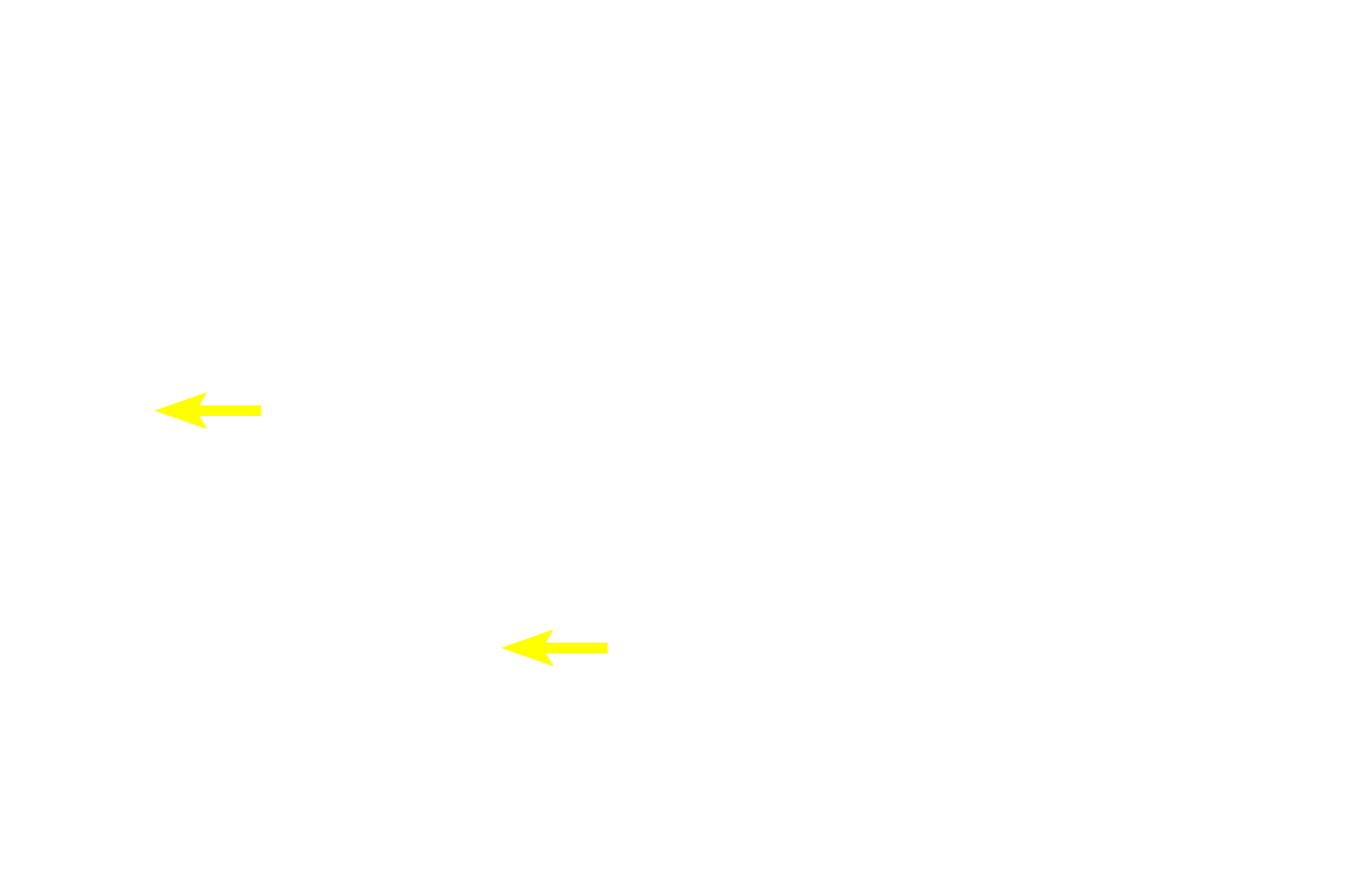 Sertoli cells <p>This region of the seminiferous epithelium contains numerous spermatogonia. These cells are identified as spermatogonia based on their location next to the basement membrane. The primary spermatocytes resulting from the mitotic divisions of spermatogonia migrate into the adluminal compartment where they rapidly enter prophase of meiosis I. 1000x</p>
