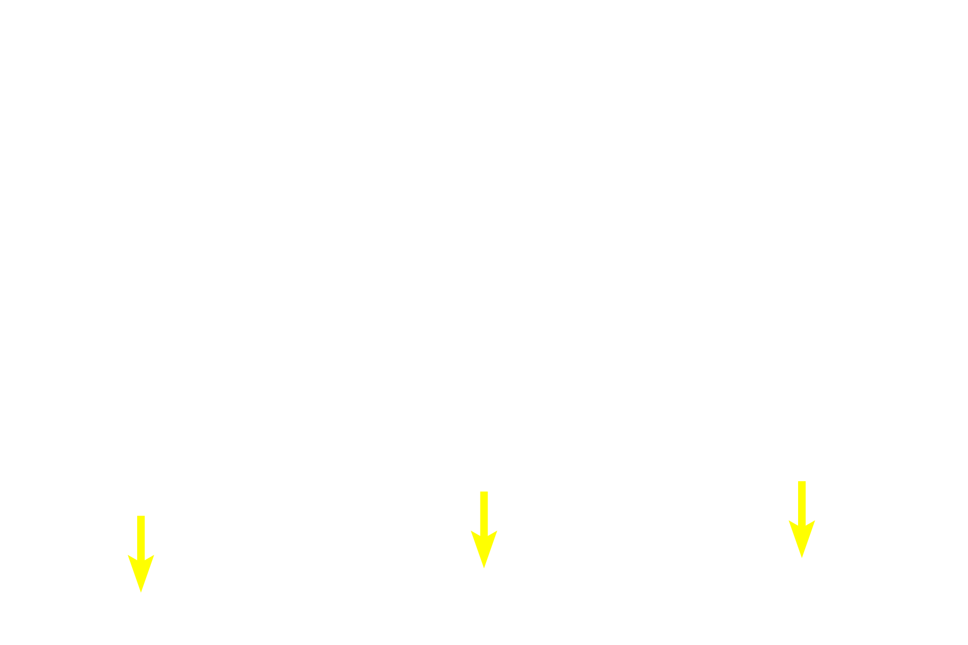 Tunica propria <p>This region of the seminiferous epithelium contains numerous spermatogonia. These cells are identified as spermatogonia based on their location next to the basement membrane. The primary spermatocytes resulting from the mitotic divisions of spermatogonia migrate into the adluminal compartment where they rapidly enter prophase of meiosis I. 1000x</p>
