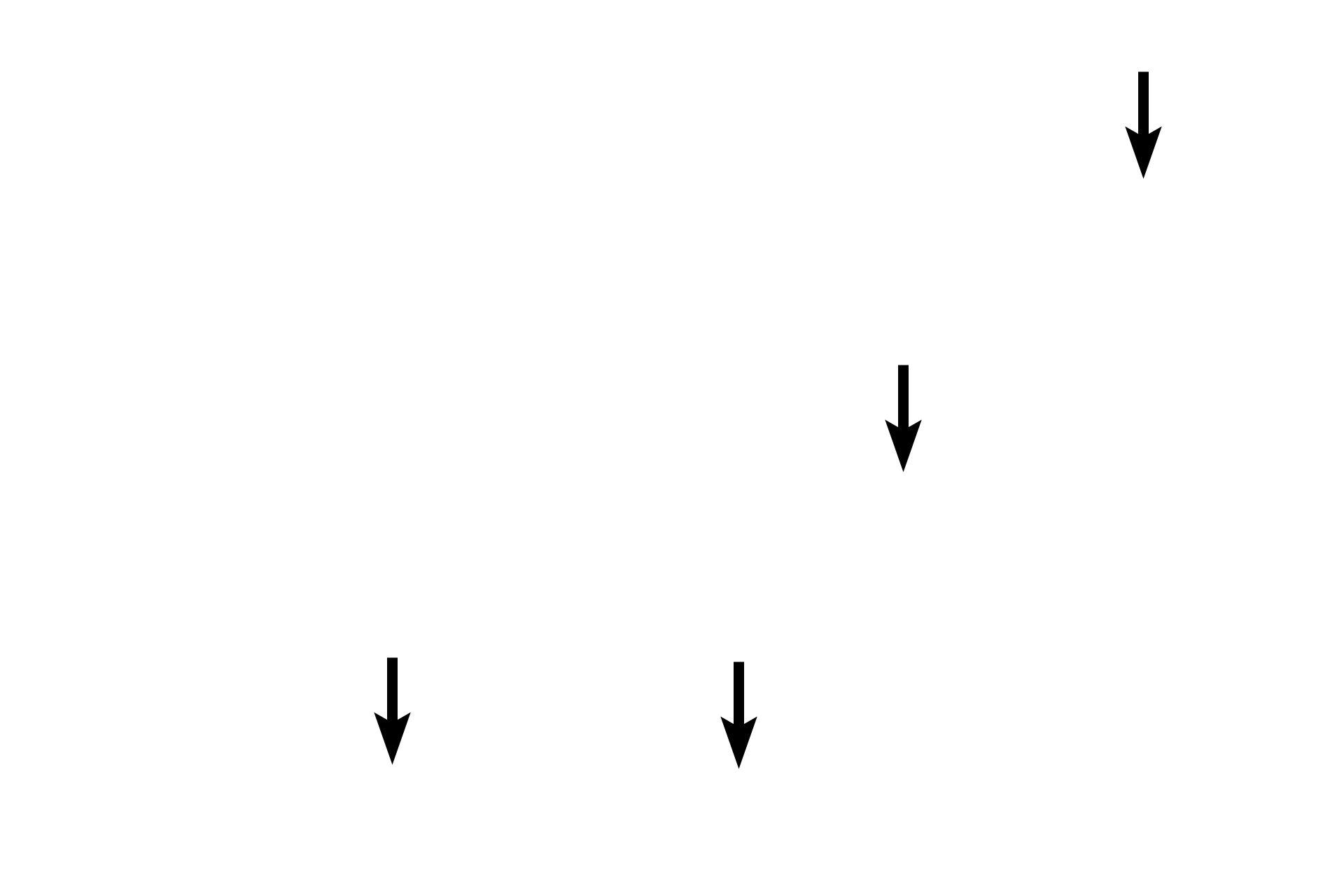 Leydig (interstitial) cells <p>The testis proper is composed primarily of the convoluted portions of the seminiferous tubules, the exocrine portion of the gland. Each tubule is surrounded by layer of myoid cells called the tunica propria. Leydig (interstitial) cells constitute the endocrine division of the testis and are located in the connective tissue stroma between the convoluted portions. Leydig cells produce androgens under the influence of luteinizing hormone from the pars distalis of the pituitary gland. 400x</p>
