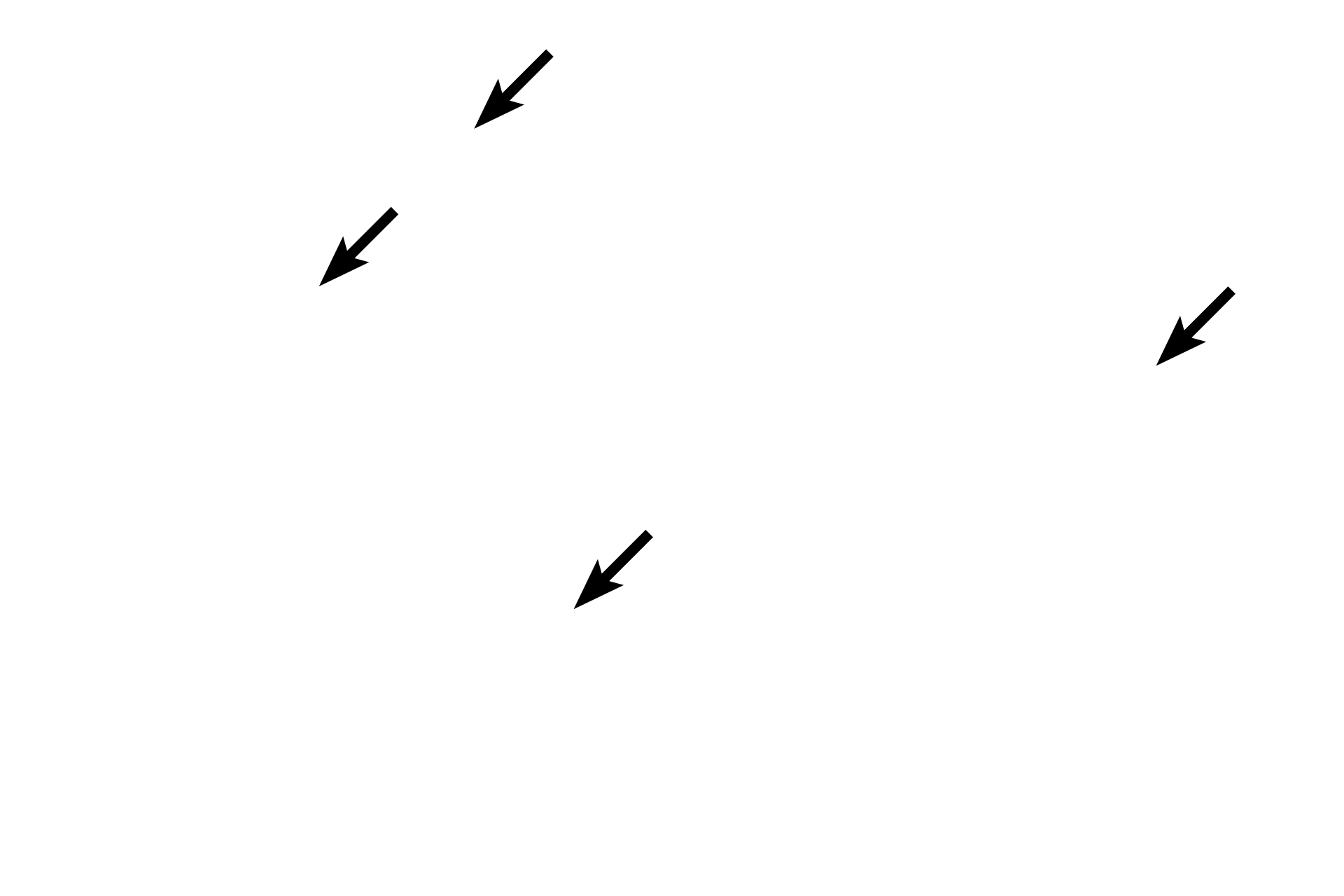 Tunica propria <p>The testis proper is composed primarily of the convoluted portions of the seminiferous tubules, the exocrine portion of the gland. Each tubule is surrounded by layer of myoid cells called the tunica propria. Leydig (interstitial) cells constitute the endocrine division of the testis and are located in the connective tissue stroma between the convoluted portions. Leydig cells produce androgens under the influence of luteinizing hormone from the pars distalis of the pituitary gland. 400x</p>
