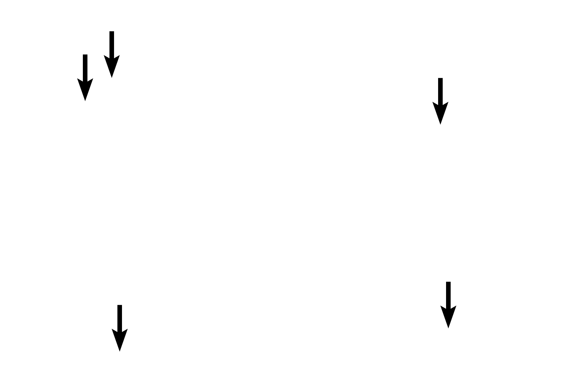 Leydig (interstitial) cells <p>Leydig (interstitial) cells are located in the tissue between the convoluted portions of the seminiferous tubules and constitute the endocrine portion of the testis.  They secrete testosterone under the influence of luteinizing hormone from the pars distalis of the pituitary gland. Blood vessels and lymphatics are abundant in the interstitium surrounding these cells. 400x</p>
