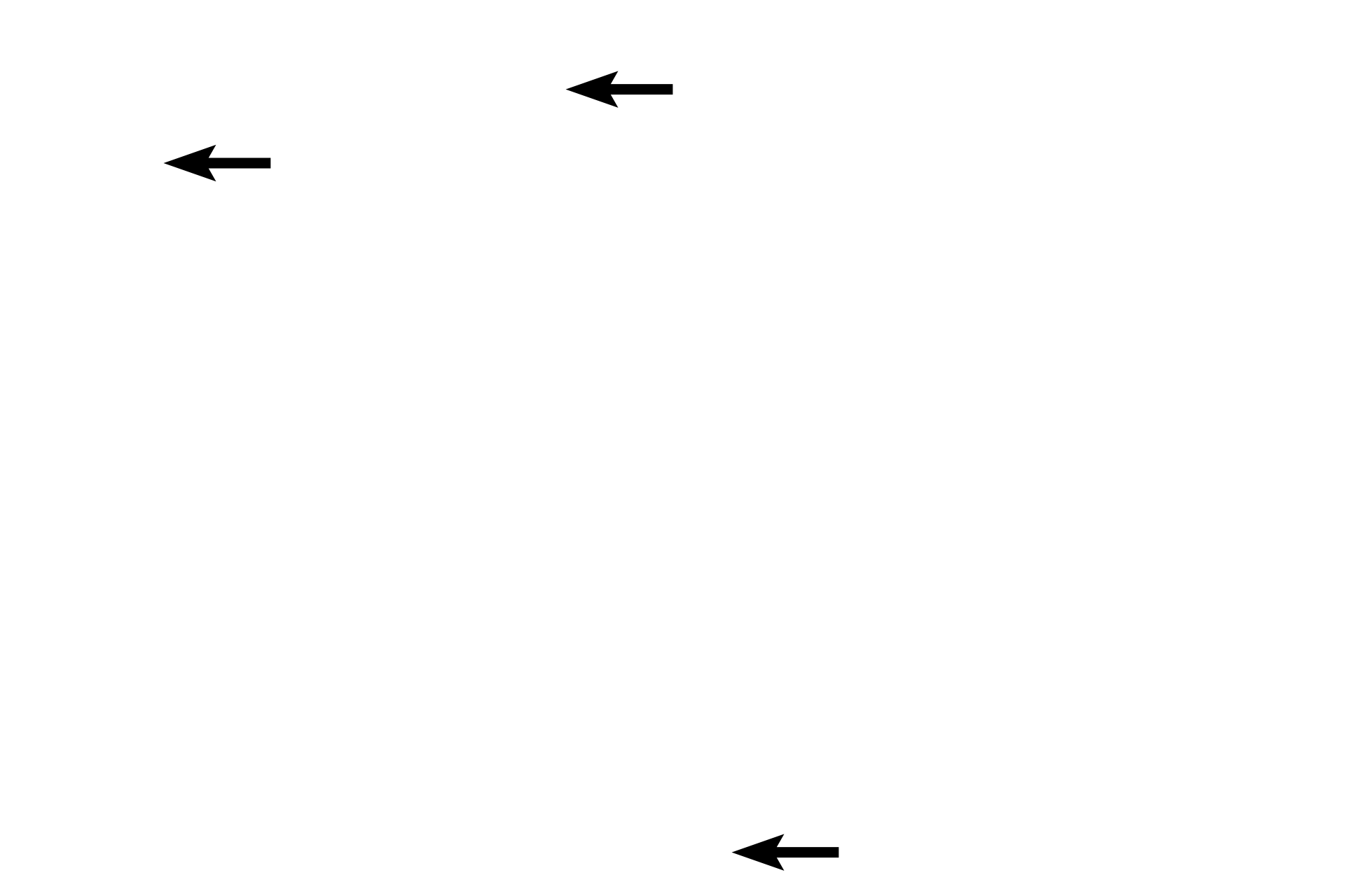 Blood vessels <p>Leydig (interstitial) cells are located in the tissue between the convoluted portions of the seminiferous tubules and constitute the endocrine portion of the testis.  They secrete testosterone under the influence of luteinizing hormone from the pars distalis of the pituitary gland. Blood vessels and lymphatics are abundant in the interstitium surrounding these cells. 400x</p>
