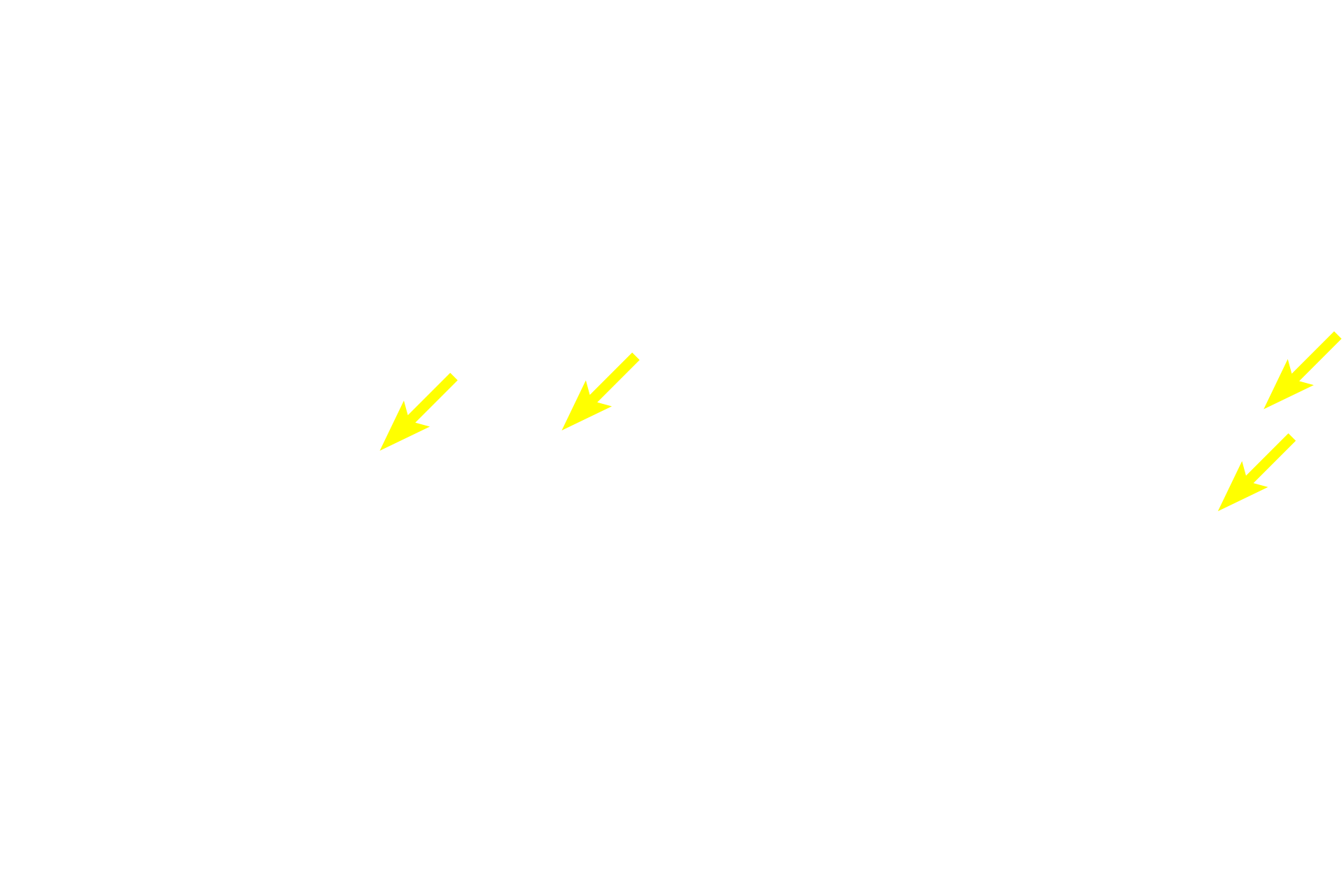 Sertoli cells > <p>Sertoli cells extend the entire thickness of the epithelium. Their cell outline is difficult to discern because of numerous lateral processes extending around developing germ cells. Therefore, Sertoli cells must be identified primarily by their nuclei, which are oval, euchromatic, infolded and display a prominent nucleolus.  Lateral extensions from adjacent Sertoli cells form occluding, tight junctions that form the blood-testis barrier.</p>
