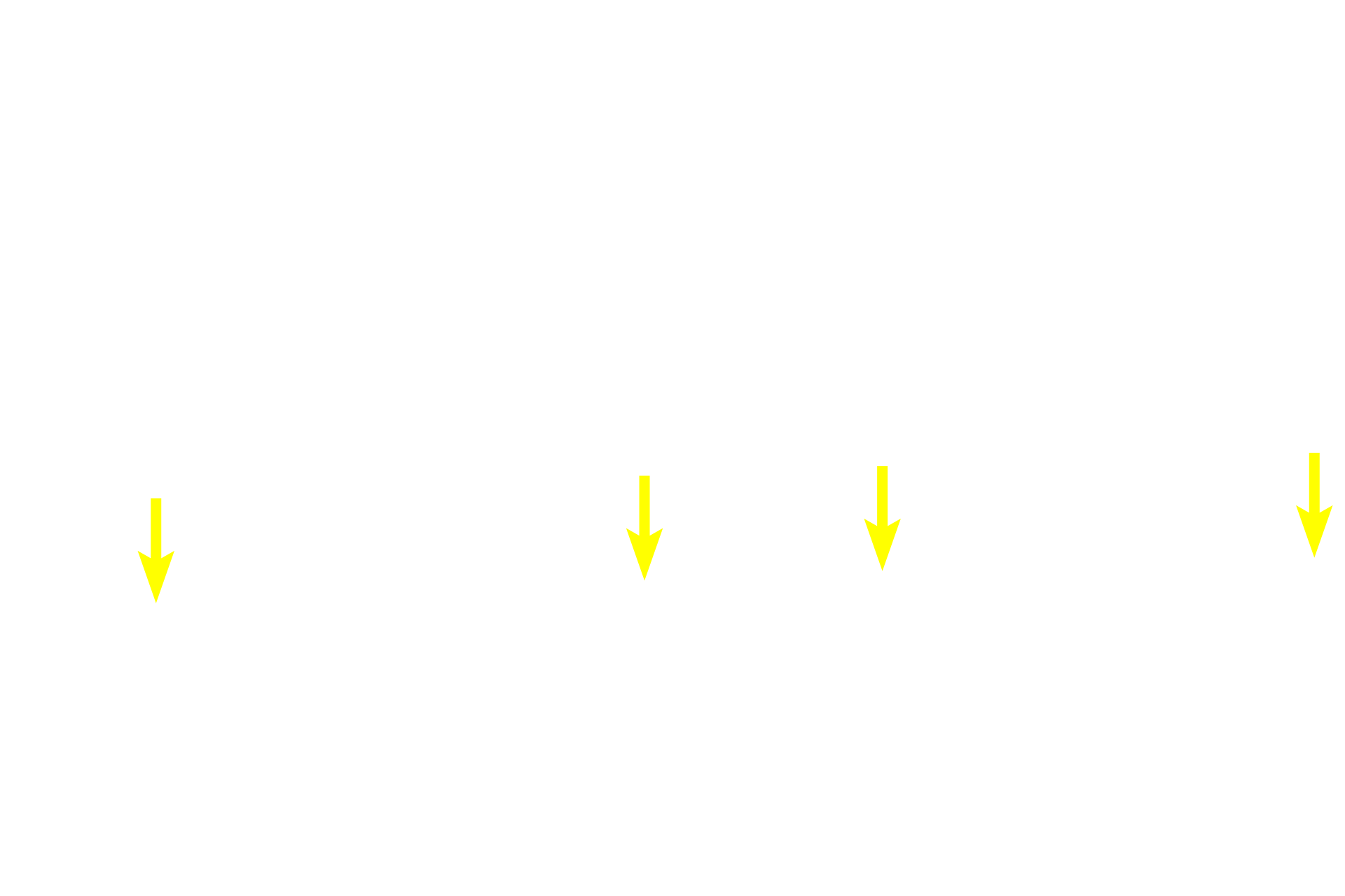 Spermatogonia > <p>Spermatogonia are diploid, somatic cells that always lie on the basal lamina of the epithelium; they are the earliest of the germ cell line. Spermatogonia divide by mitosis to perpetuate themselves or to form primary spermatocytes. The diameter of these nuclei can be used for comparison in identifying the other later germ cells.</p>
