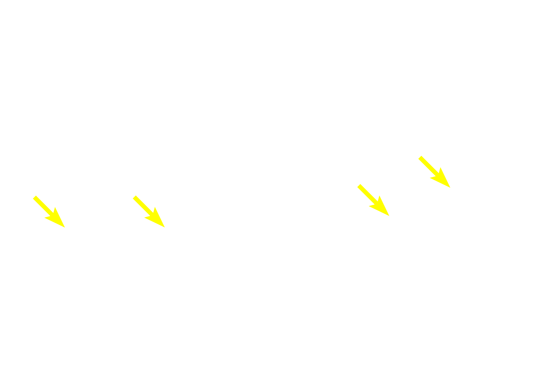 Primary spermatocytes > <p>Primary spermatocytes are diploid cells that form in the basal compartment but quickly move through the blood-testis barrier to the adluminal compartment. They contain prominent, condensed chromosomes and many primary spermatocytes are seen because they remain in prophase of the first meiotic division for an extended period of time. </p>
