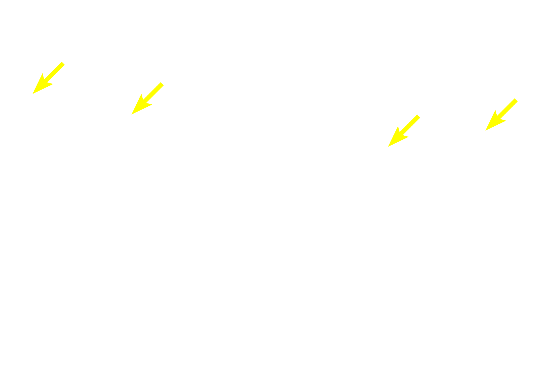 Spermatids late <p>Spermatids are haploid cells formed when secondary spermatocytes complete the second meiotic division. Early spermatid nuclei are spherical and smaller than spermatogonia nuclei. Spermatids do not divide but differentiate by condensing and elongating their nuclei, developing a flagellum and losing excess cytoplasm. Cytoplasmic continuity between adjacent spermatids is lost during this process.  The image on the right is at a different developmental stage and lacks spermatids.</p>
