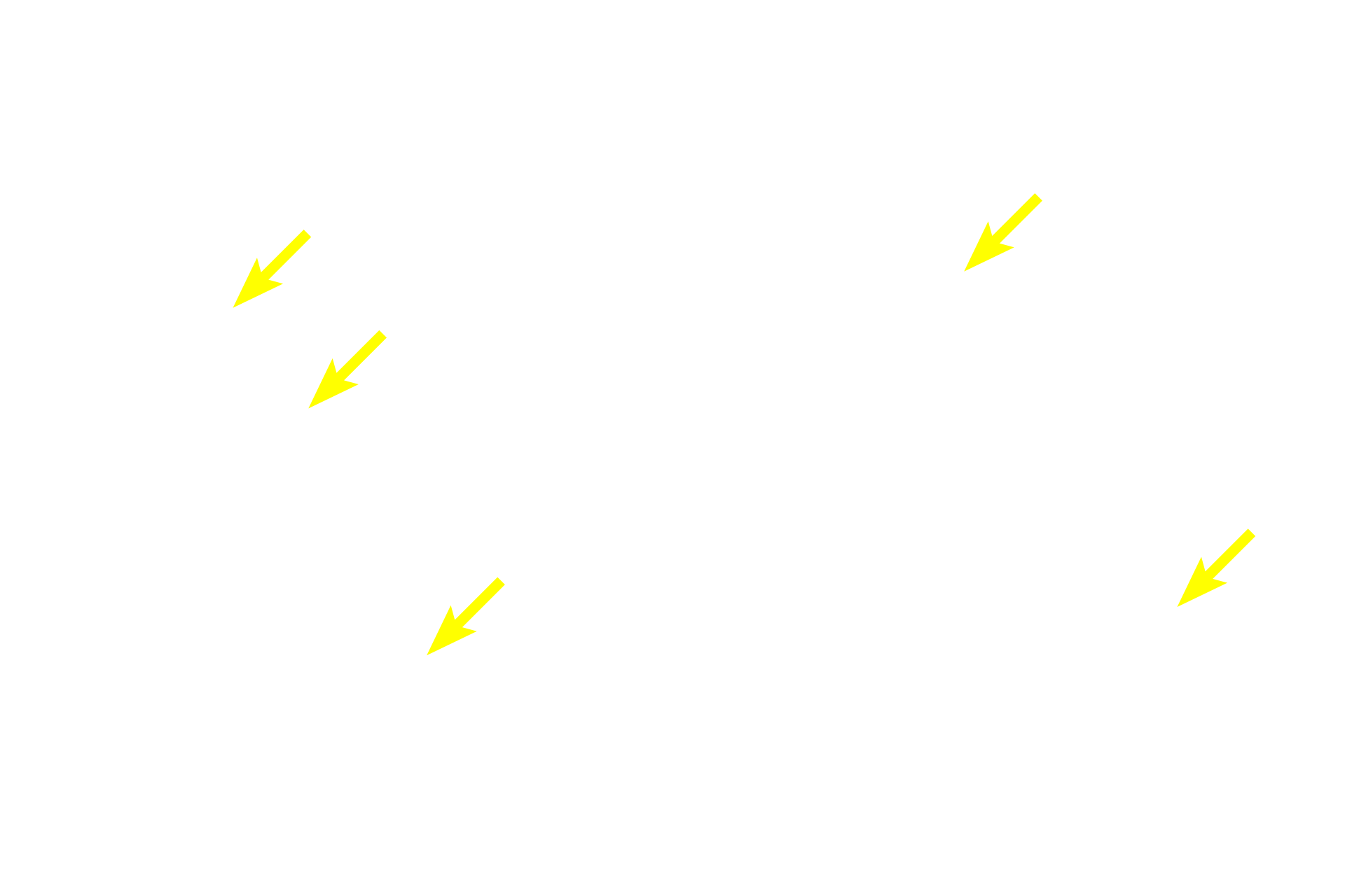 Primary spermatocytes <p>Spermatogonia and early primary spermatocytes are located in the basal compartment created by the blood-testis barrier. Older primary spermatocytes, secondary spermatocytes and spermatids, all located in the adluminal compartment, are provided with a specialized environment of high testosterone levels and protection from an autoimmune attack. 600x</p>

