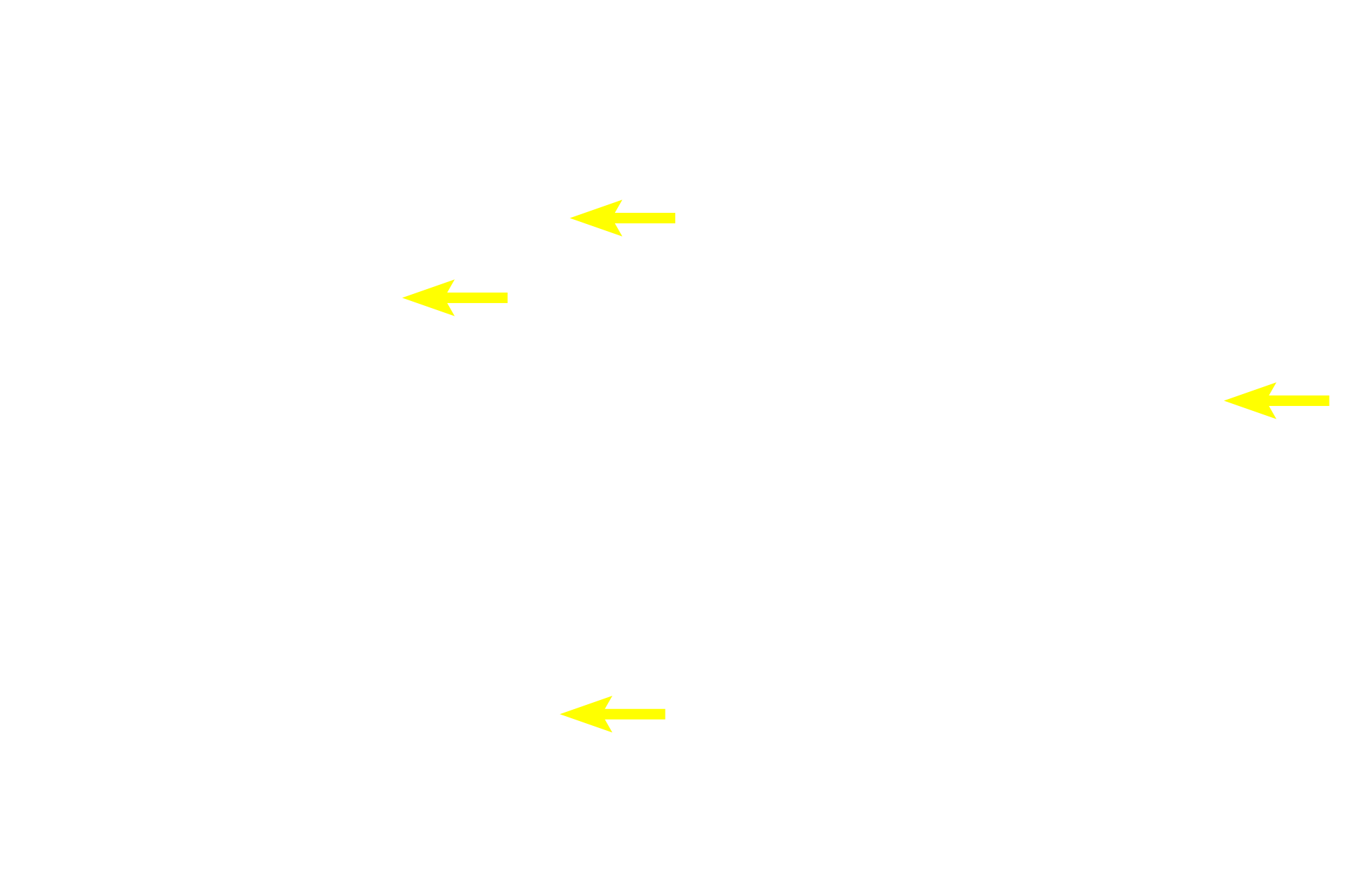 Sertoli cells > <p>Sertoli cells extend the entire thickness of the epithelium. Lateral extensions from adjacent Sertoli cells form occluding, tight junctions that constitute the blood-testis barrier.  The area deep to the barrier, the basal or abluminal compartment, contains spermatogonia. Above the barrier is the apical or adluminal compartment and contains the later stages of spermatogenesis. Sertoli cells do not divide.</p>
