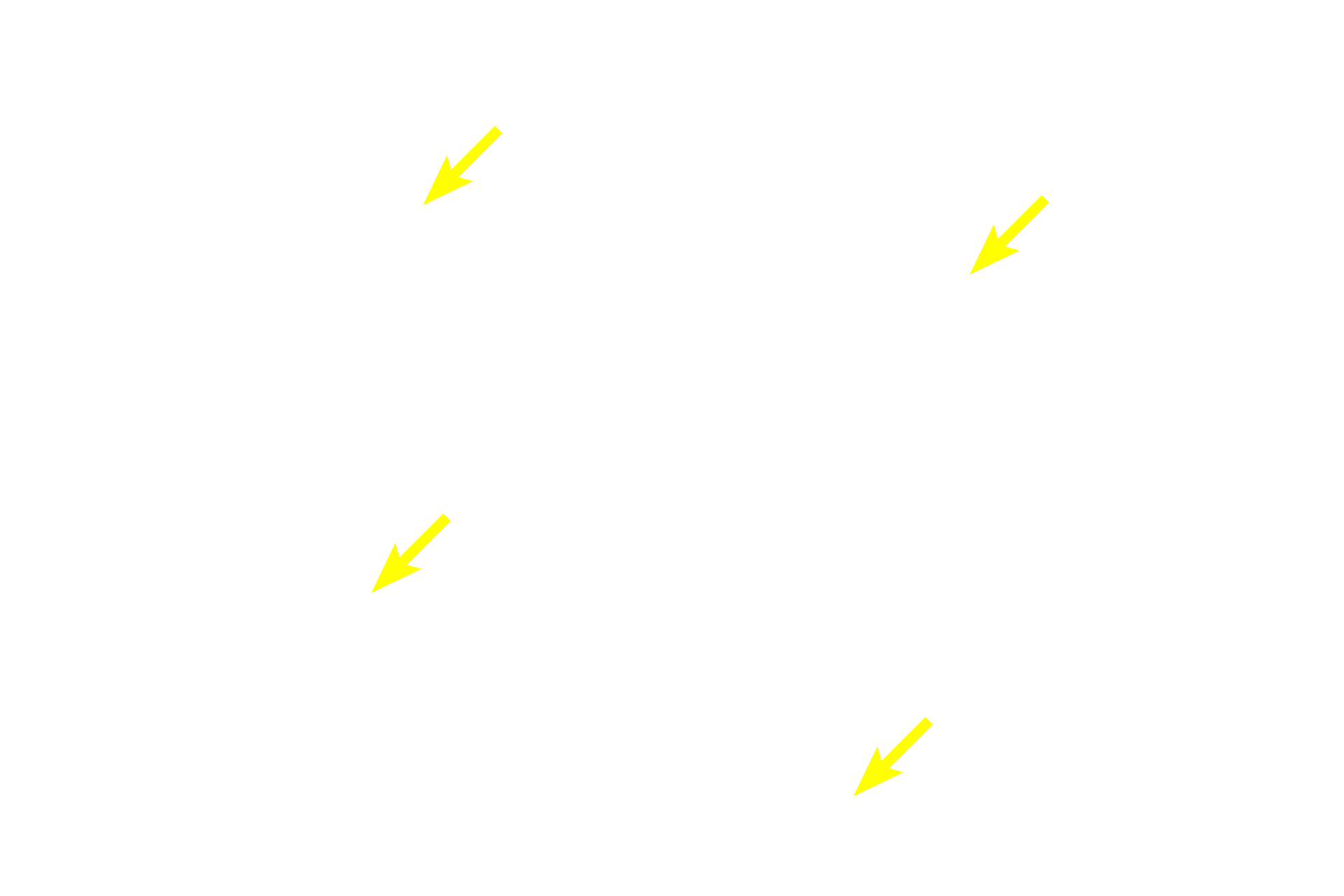 Primary spermatocytes <p>Spermatogonia and early primary spermatocytes are located in the basal compartment created by the blood-testis barrier. Older primary spermatocytes, secondary spermatocytes and spermatids, all located in the adluminal compartment, are provided with a specialized environment of high testosterone levels and protection from an autoimmune attack. 600x</p>
