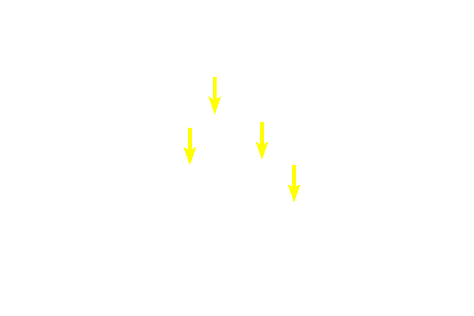 Residual bodies <p>Spermatogonia and early primary spermatocytes are located in the basal compartment created by the blood-testis barrier. Older primary spermatocytes, secondary spermatocytes and spermatids, all located in the adluminal compartment, are provided with a specialized environment of high testosterone levels and protection from an autoimmune attack. 600x</p>
