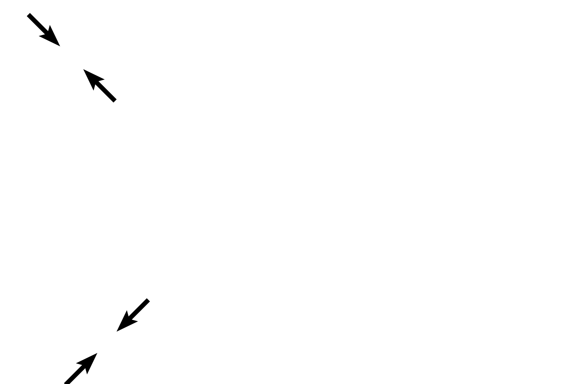 Tunica albuginea <p>The same layers surround the testis proper in the adult (seen here) that were identified in the immature testis. Growth of the seminiferous tubules during puberty flattens the mediastinum into a wedge positioned at the posterior edge of the testis. Sperm are produced in the seminiferous tubules and moved into the rete testis in the mediastinum by peristaltic contractions along the length of the seminiferous tubules. 10x, 100x</p>
