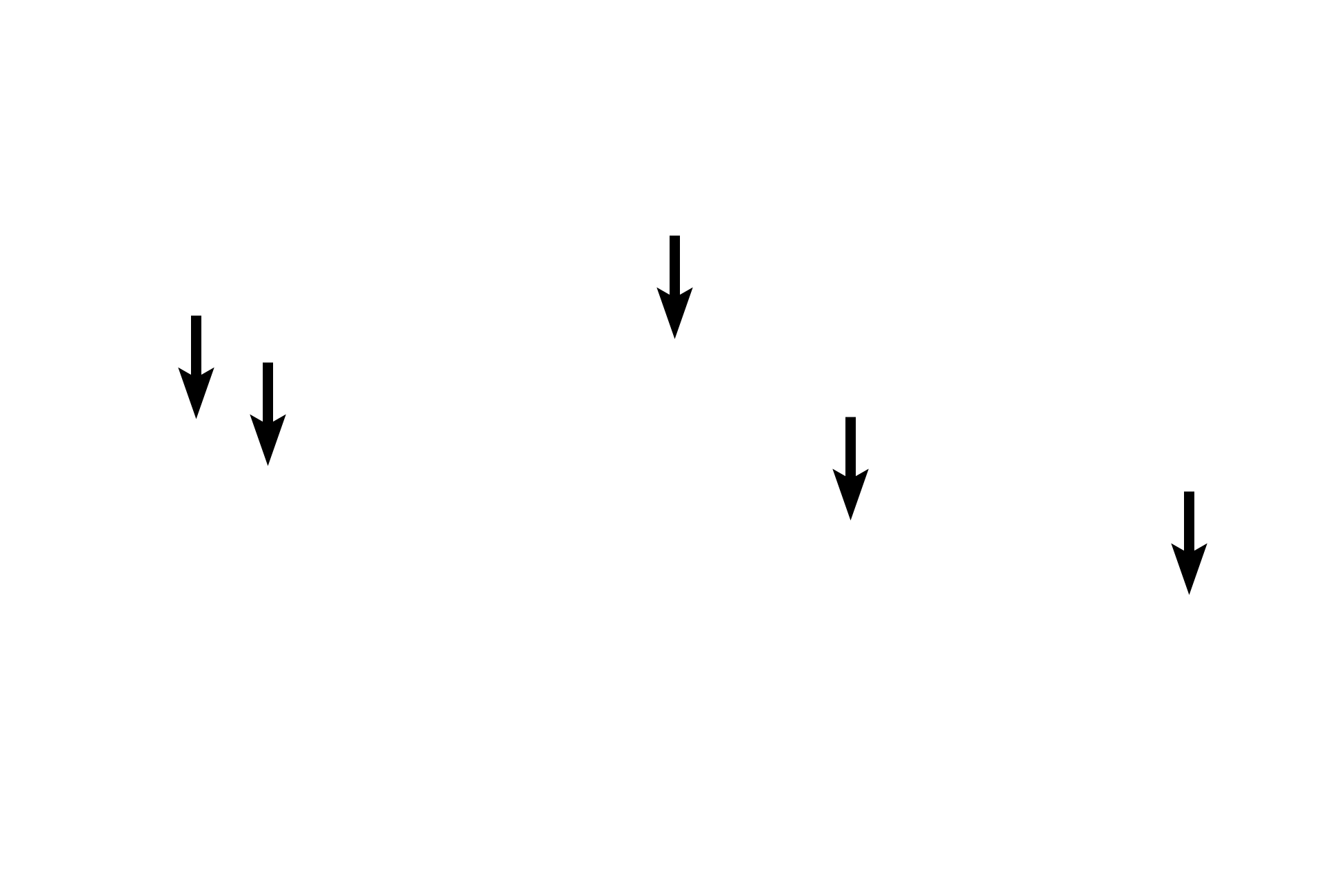 Rete testis <p>The same layers surround the testis proper in the adult (seen here) that were identified in the immature testis. Growth of the seminiferous tubules during puberty flattens the mediastinum into a wedge positioned at the posterior edge of the testis. Sperm are produced in the seminiferous tubules and moved into the rete testis in the mediastinum by peristaltic contractions along the length of the seminiferous tubules. 10x, 100x</p>
