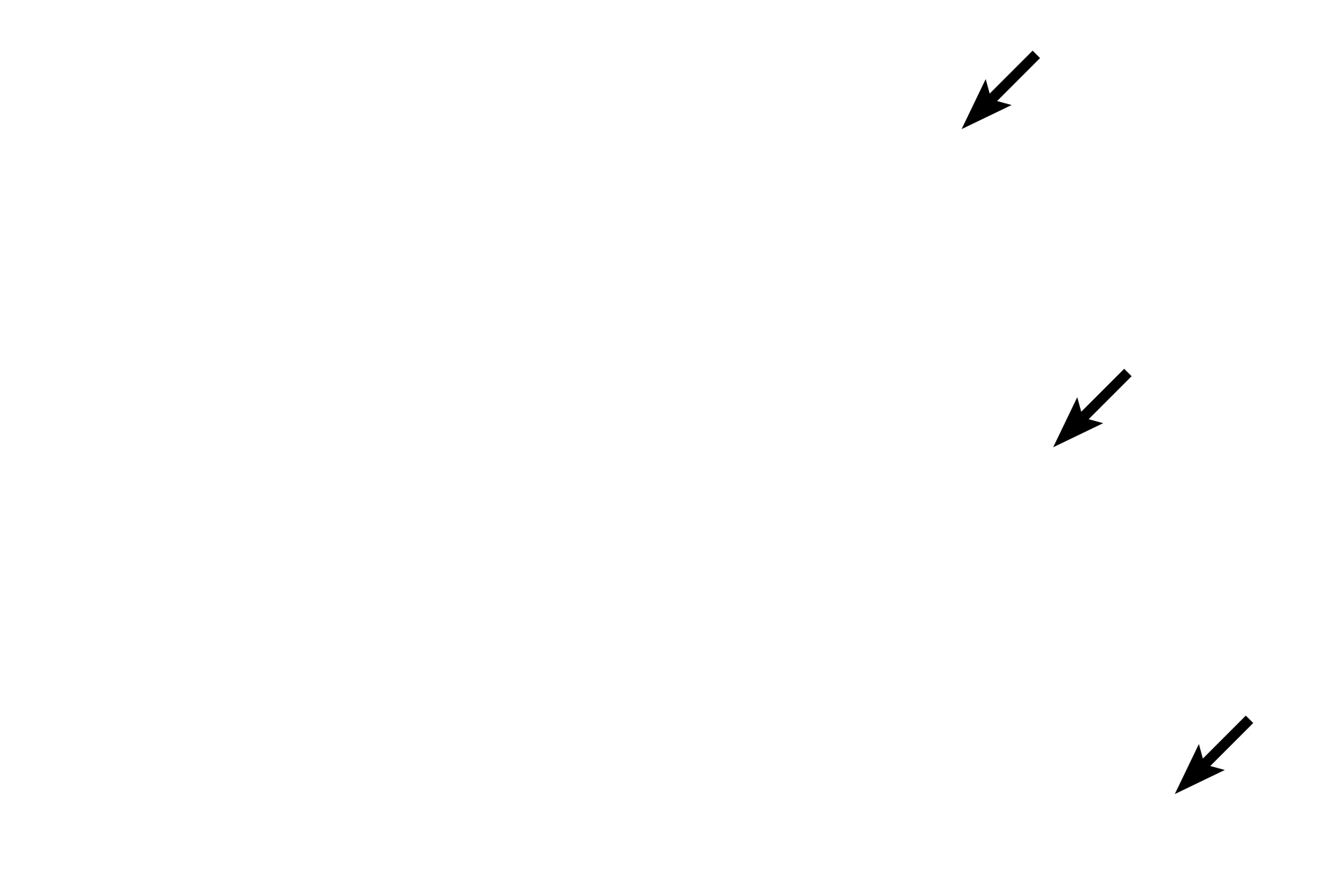 Tunica albuginea <p>From the mediastinum, the rete testis courses through the tunica albuginea to enter the head of the epididymis, where it is continuous with the efferent ducts.  Efferent ducts are coiled to form the coni vasculosi, a major portion of the head of the epididymis.  Efferent ducts anastomose to form the duct of the epididymis (not shown in this image).  10x</p>

