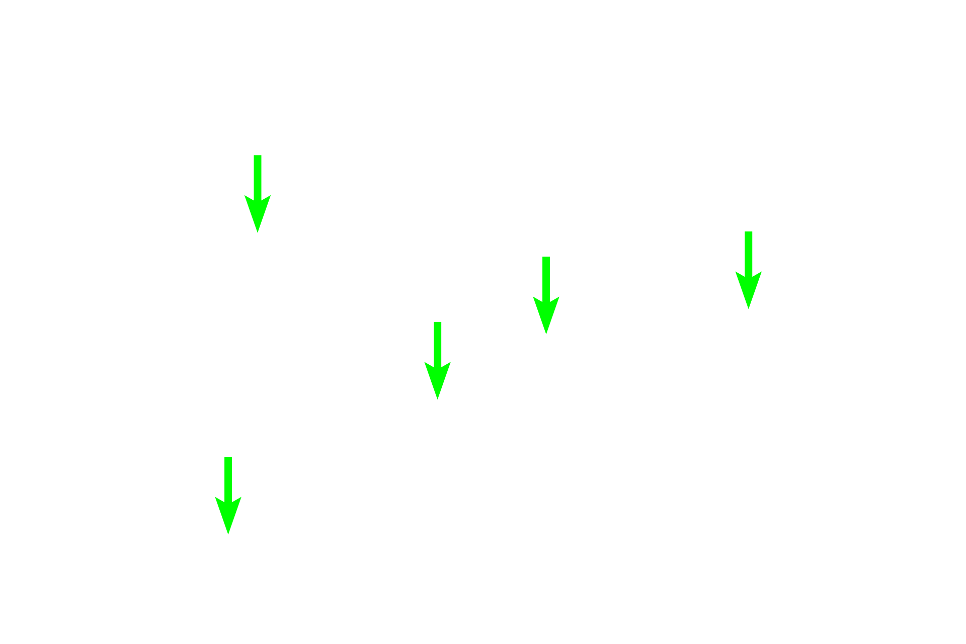 Seminiferous tubules - Straight portions  <p>This section demonstrates the convoluted portions of seminiferous tubules converging at the mediastinum. As they approach, these tubules lose the seminiferous epithelium and become the straight portions (tubuli recti) of the seminiferous tubules. Straight tubules, lined by modified Sertoli cells, continue into the rete testis, located within the mediastinum. 100x</p>
