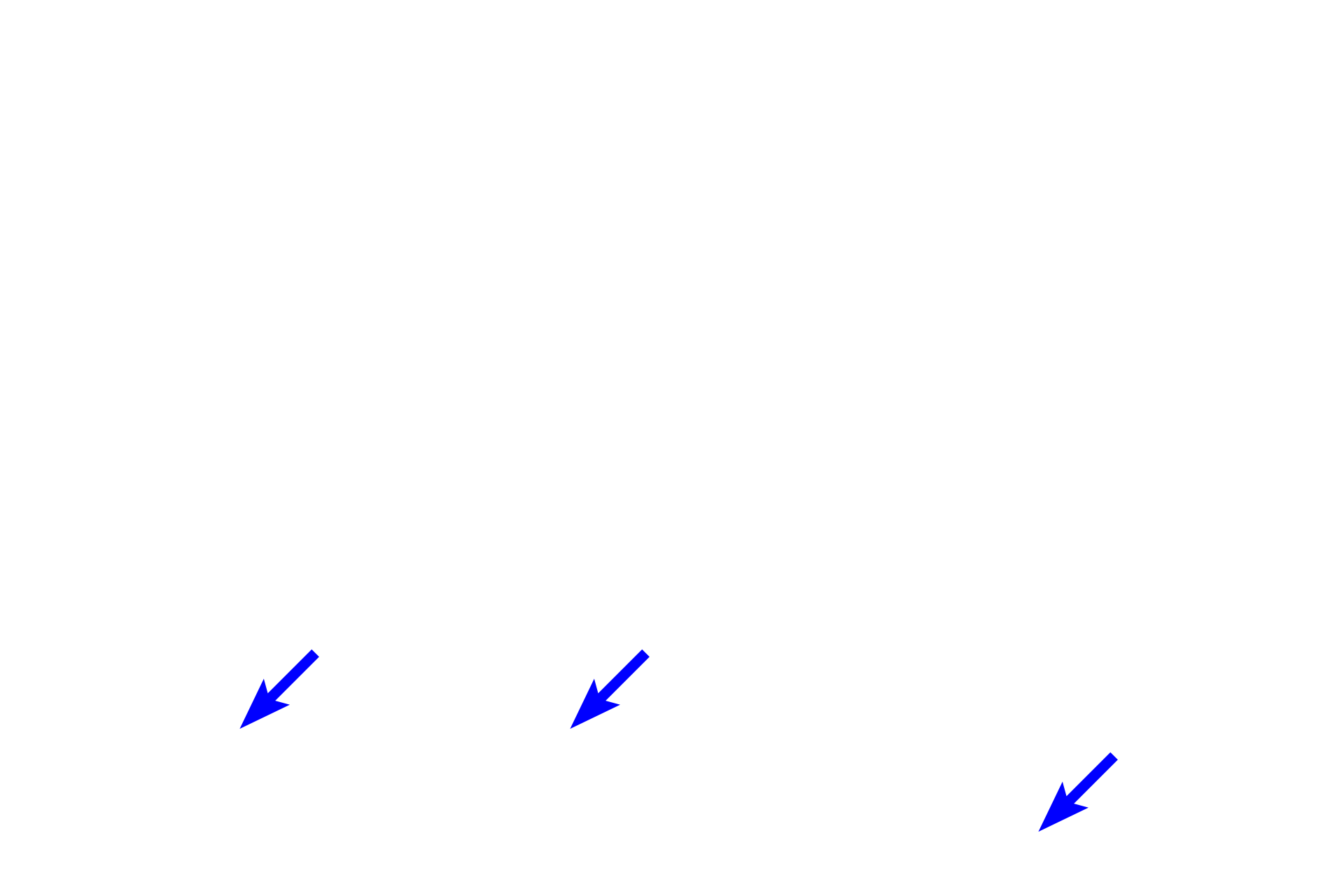 Stratum basale <p>There is normally an abrupt transition between the stratum granulosum and the stratum corneum.  Stratum corneum consists of non-living keratinized cells or squames that consists of a cornified cell envelope surrounding a matrix of aggregated tonofibrils. These cells are continuously shed from the surface of the epidermis and are replenished through the upward migration and ongoing keratinization of epidermal keratinocytes.  The keratin matrix accounts for the strong eosinophilic staining seen in these cells.  400x</p>
