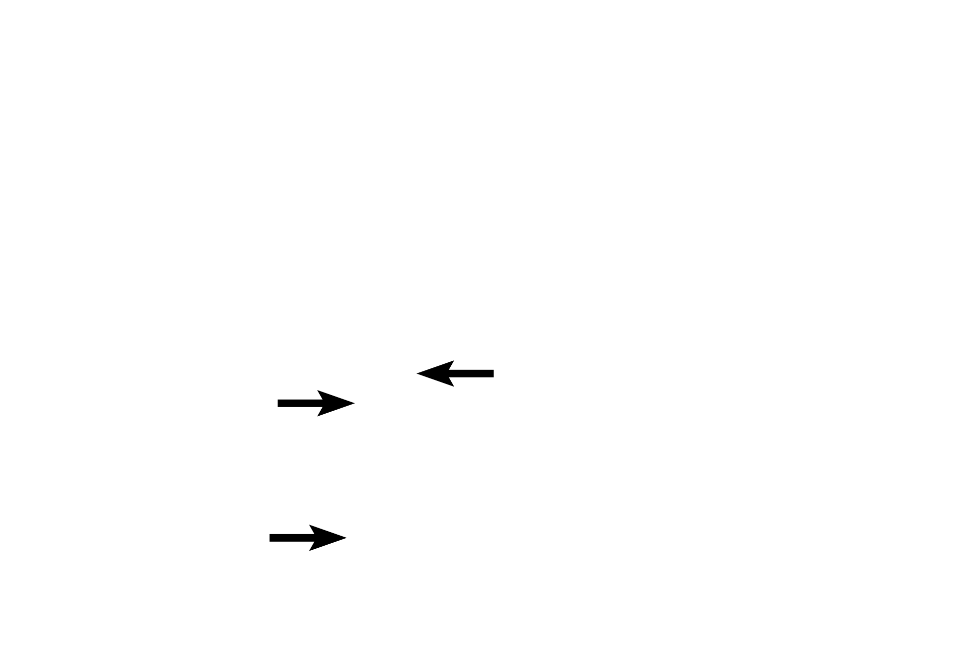  - Pars intermedia > <p>The pars intermedia is located at the interface of the pars distalis and pars nervosa and its cells often migrate into the pars distalis.</p>

