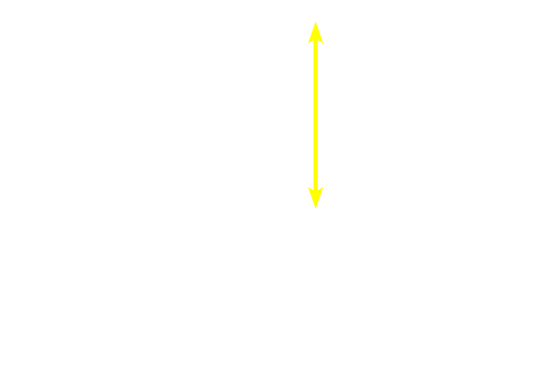  - Pars nervosa <p>This image shows a horizontal section through the human pituitary at the level indicated in the previous image.  The contrast between the pale-staining neural tissue and the deeply basophilic staining of the glandular adenohypophyseal tissue is evident.  The entire pituitary is surrounded by a dense connective tissue capsule that is continuous with the dura mater.  10x</p>
