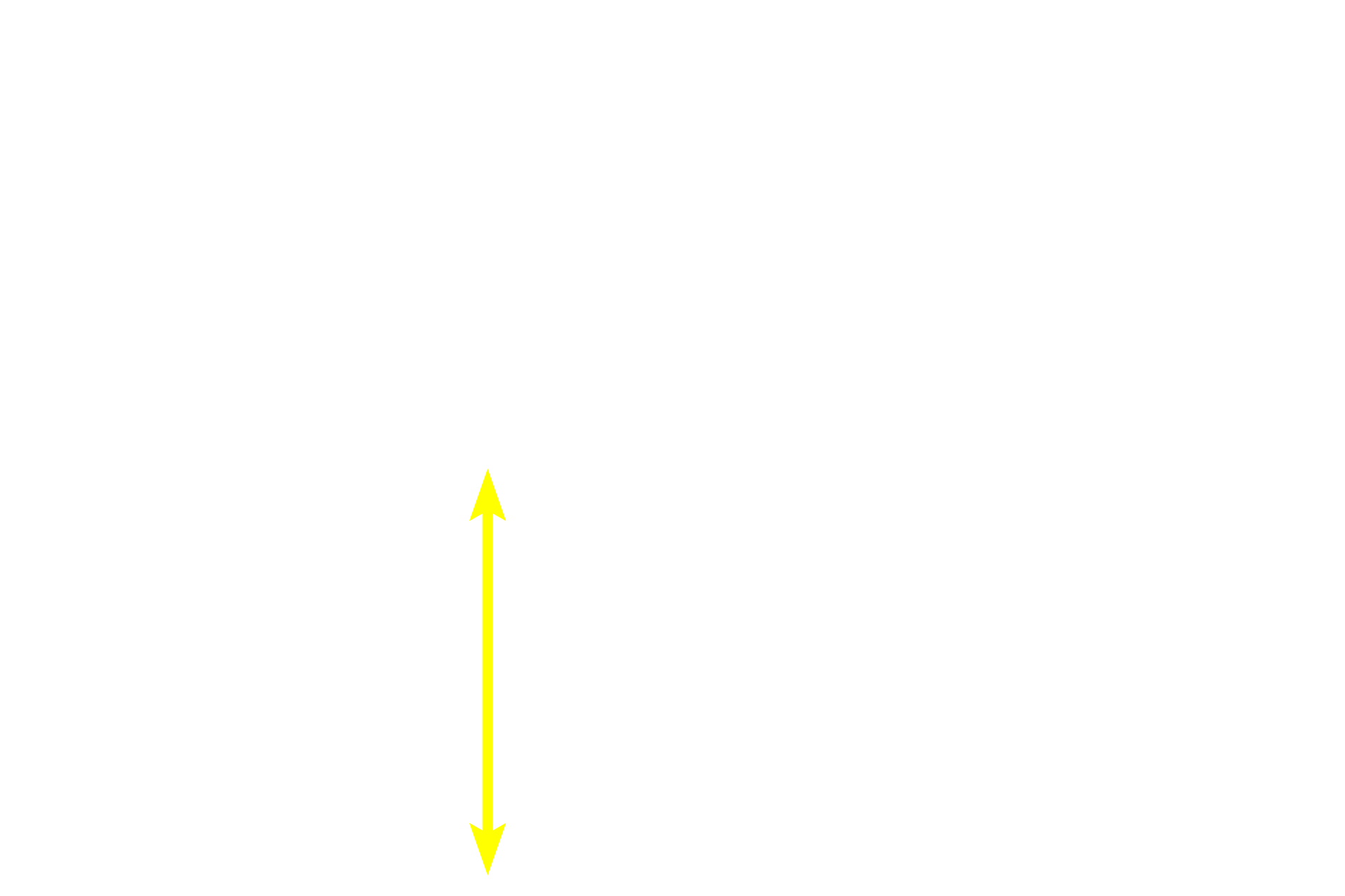  - Pars distalis <p>This image shows a horizontal section through the human pituitary at the level indicated in the previous image.  The contrast between the pale-staining neural tissue and the deeply basophilic staining of the glandular adenohypophyseal tissue is evident.  The entire pituitary is surrounded by a dense connective tissue capsule that is continuous with the dura mater.  10x</p>
